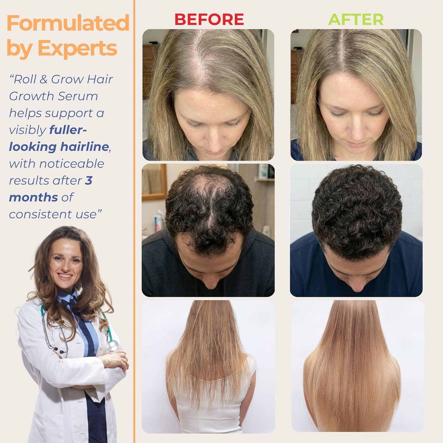 Hair Growth Serum Roll-On | 5% Rosemary & 3% Protein for Scalp Thickening - Non-Greasy Treatment, 1 fl oz (30 ml)