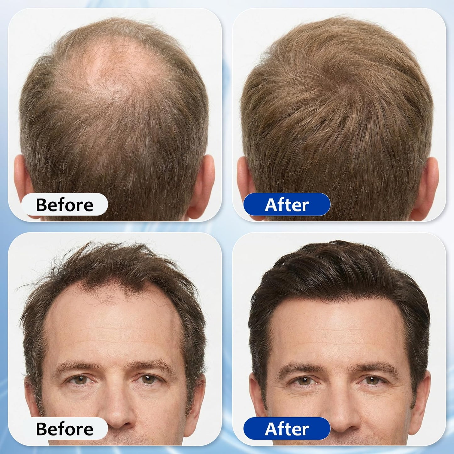 Hair Growth Serum Roll On with 3% Rosemary,3% Batana Oil,2% Pea Extract,2% Ginger Root Oil,Stronger Root,stimulate follicle,Hair Thicker,Hair Loss Treatment,Hair Growth Serum(30ML/1.01FL.OZ)