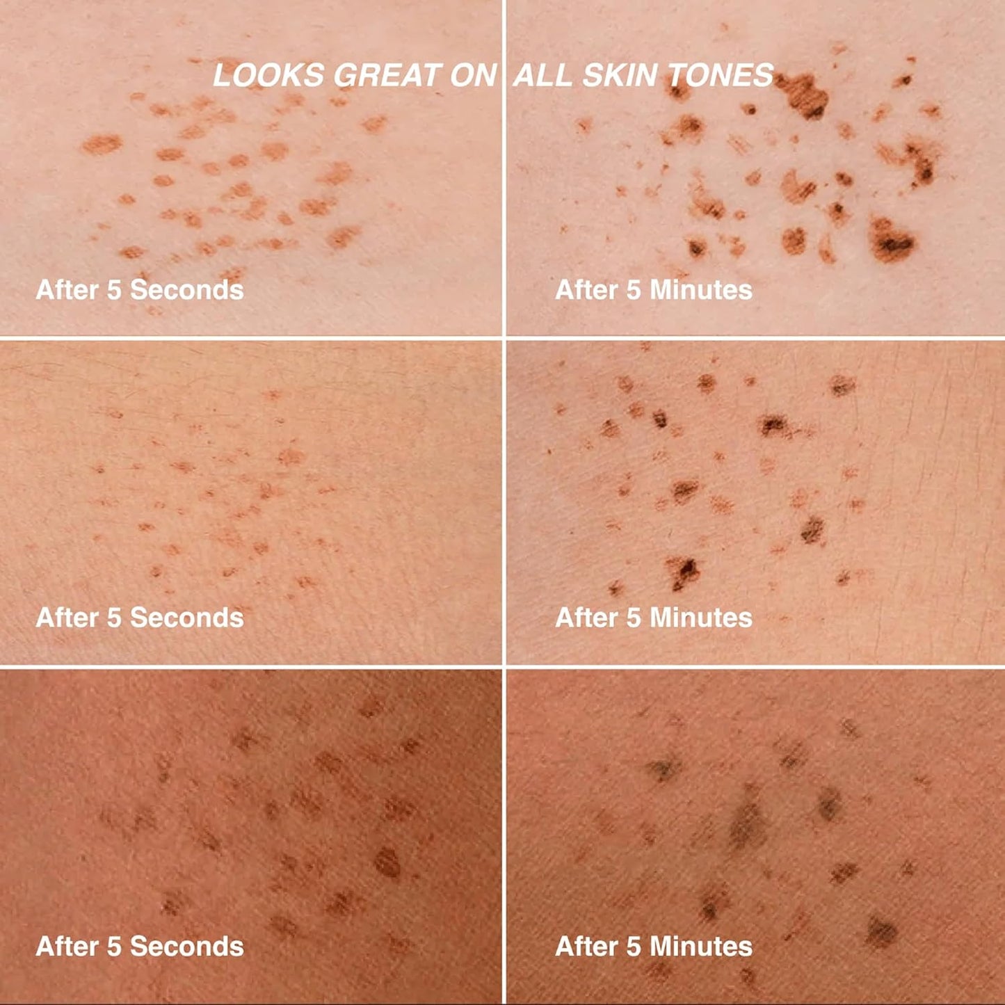 Freck XL Freckle Pen - Buildable Faux Freckles Makeup for Natural Sun-Kissed Look | Vegan, Long-Lasting Formula | Light/Medium Skin Tones