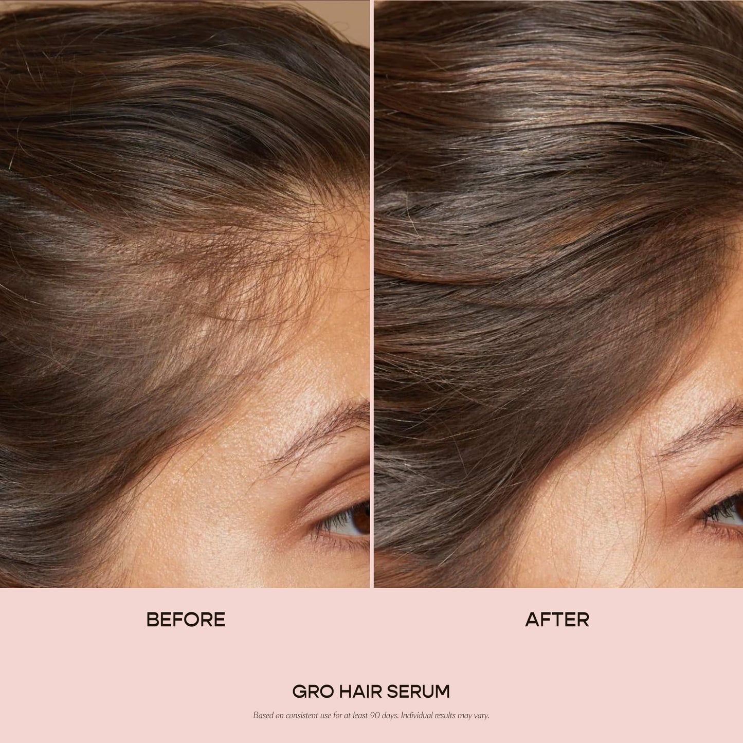 VEGAMOUR GRO Hair Serum for Hair Thinning, Thicker Fuller Looking Hair, Non Oily Tonic, 3 pack, 90 day supply