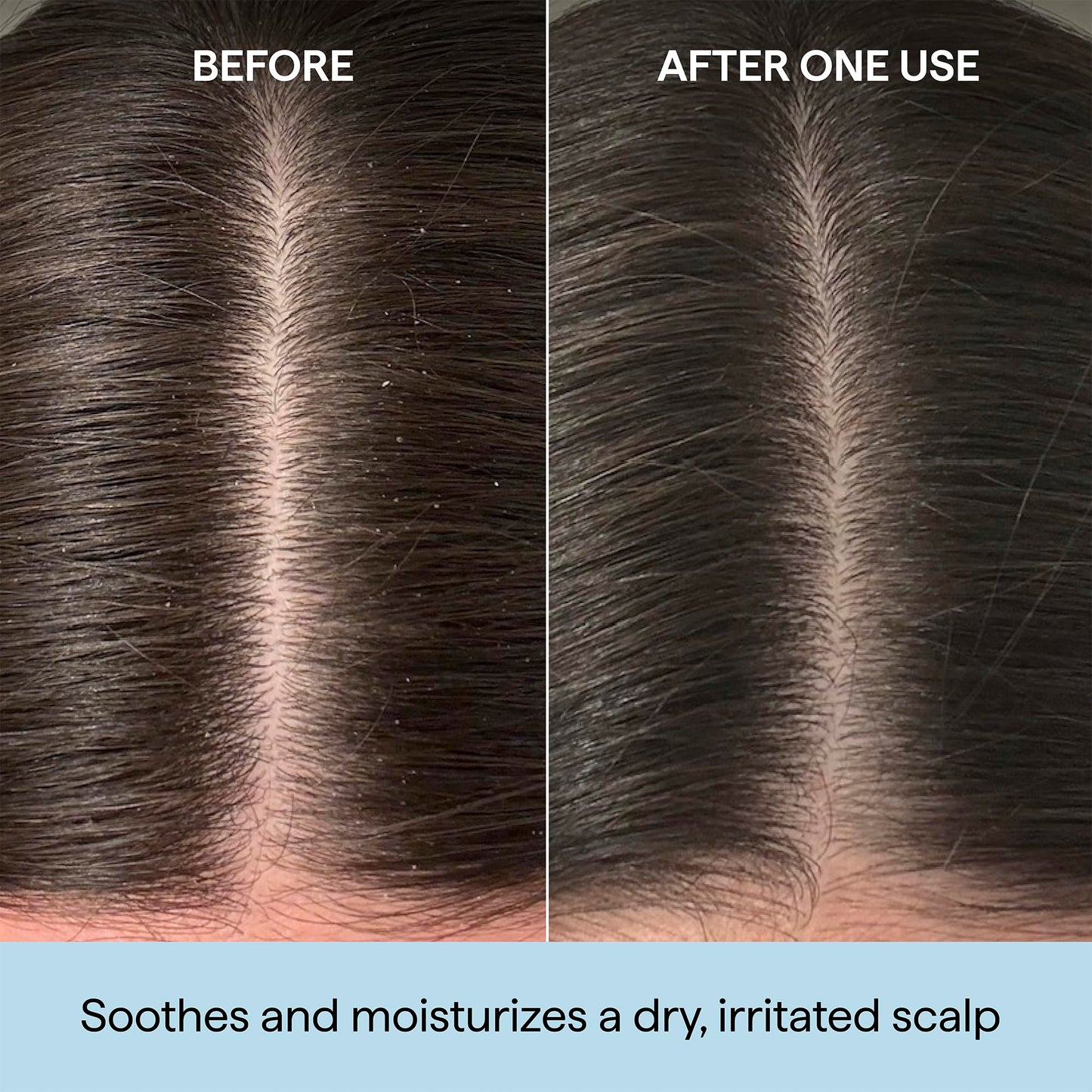 Briogeo Scalp Revival Rosemary Pre-Wash Oil | Moisturizing Scalp Treatment for Dry, Flaky, or Itchy Scalp | Strengthens Hair & Soothes Scalp | Vegan & Cruelty-Free | 3.4 oz