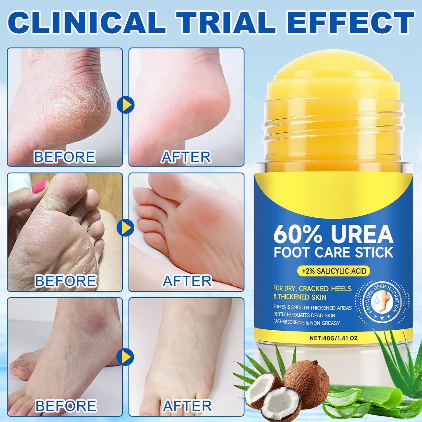 Urea Cream 60% with 2% Salicylic Acid Stick, 2Pack Urea Foot Cream for Dry Cracked Heels, Callus Remover, Hydrating and Softening Moisturizer for Feet, Hands, Knees, Elbows, Exfoliating Dead Skin