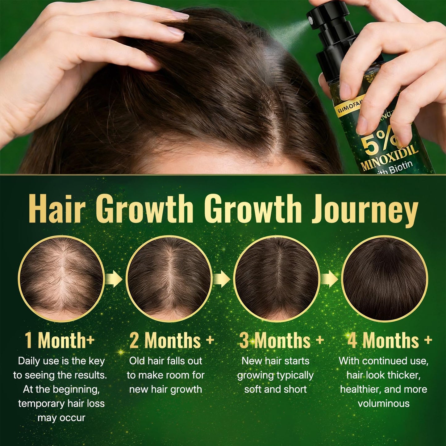 SUMIFANG 5% Minoxidil for Men & Women Hair Growth Biotin Serum with Rosemary for Hair Beard Regrowth Treatments, Unscented Topical Minoxidil Spray 80ML for Faster Stronger Thicker Hair Growth