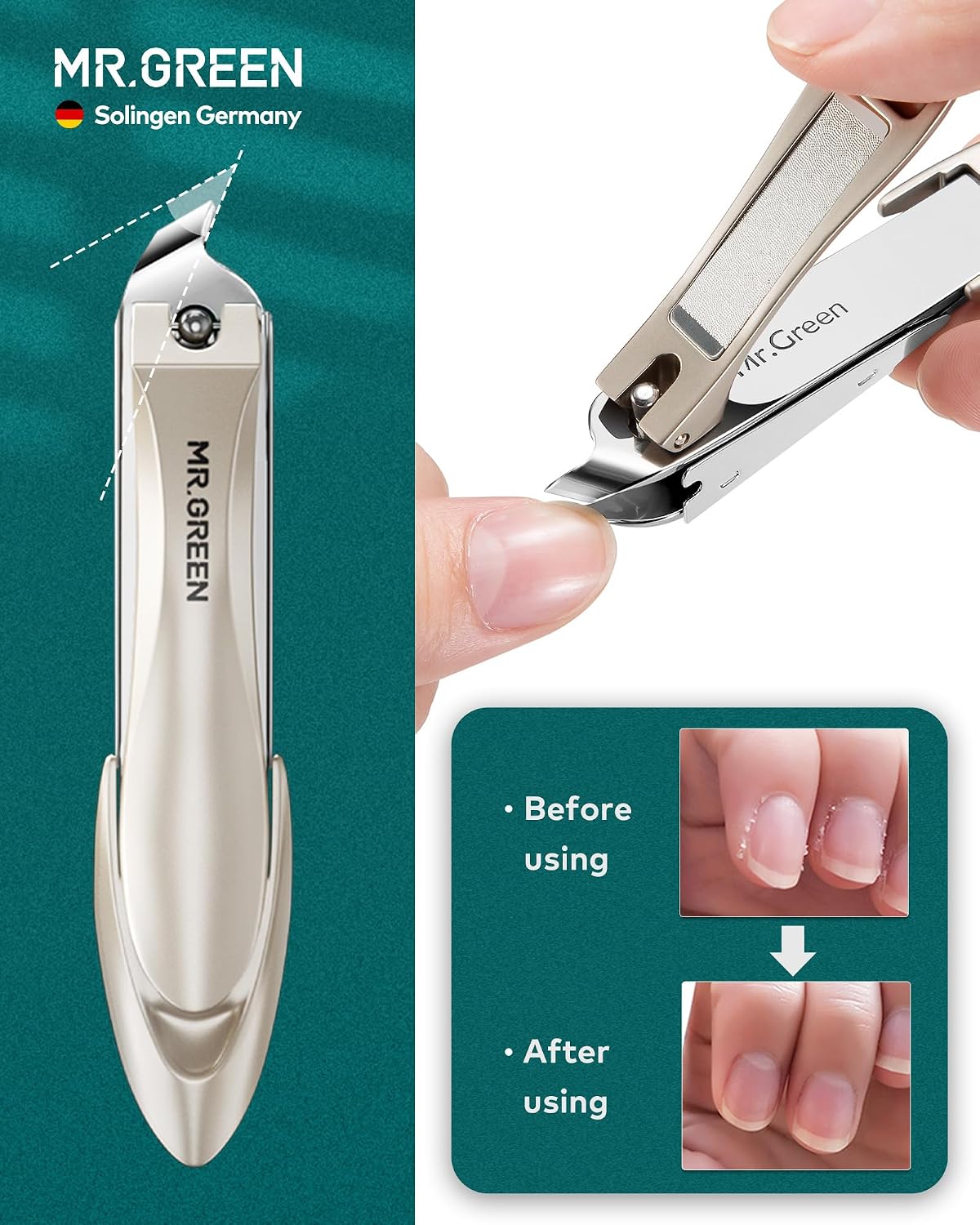 7 in 1 Manicure Set - Professional German Stainless Steel Nail Clippers Kit | Full Grooming Set with Leather Case for Men & Women