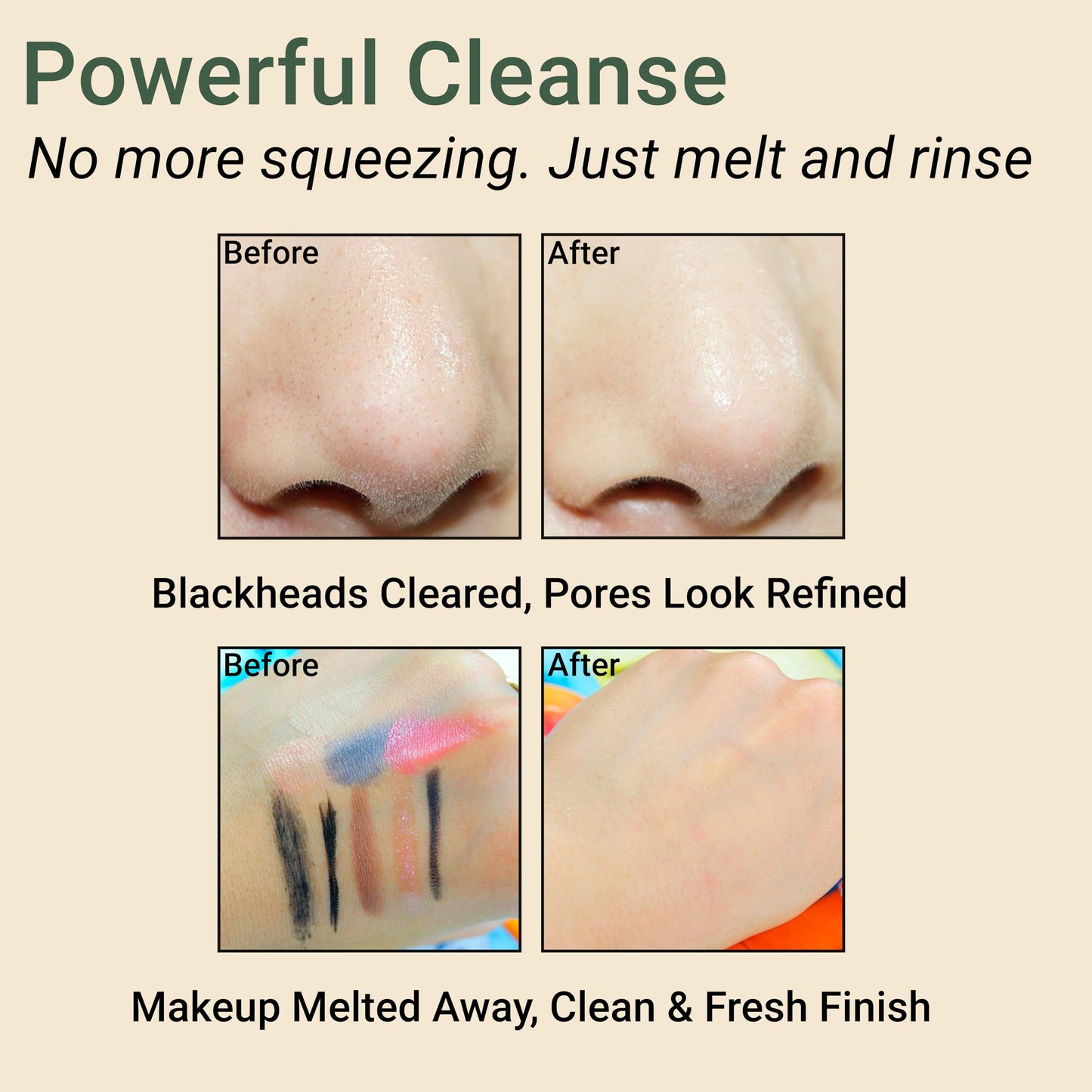 Korean Cleansing Oil Makeup Remover w/ LHA Centella Tea Tree Heartleaf Murwort & Green Tea | Lightweight Deep Pore Cleaner for Blackheads Sebum Waterproof Sunscreen & Sensitive Acne-Prone Skin 6.7 Oz