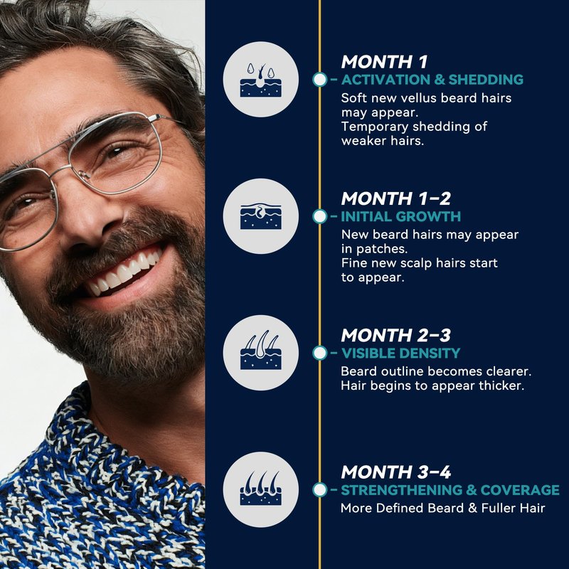 Minoxidil for Men Beard Growth Serum: Extra Strength 5% Minoxidil Spray for Men Beard and Hair Regrowth Treatments