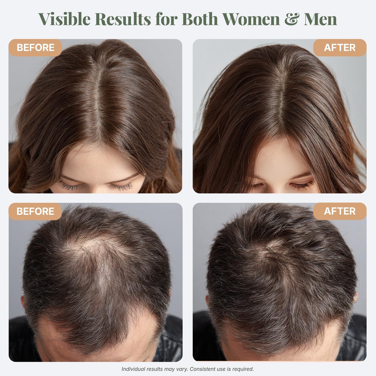 The ÉLIX USDA Organic Rosemary Oil for Hair Growth | Thickening Formula with Castor & Pumpkin Seed | for Hair Loss & Thinning | Made in USA | 4oz