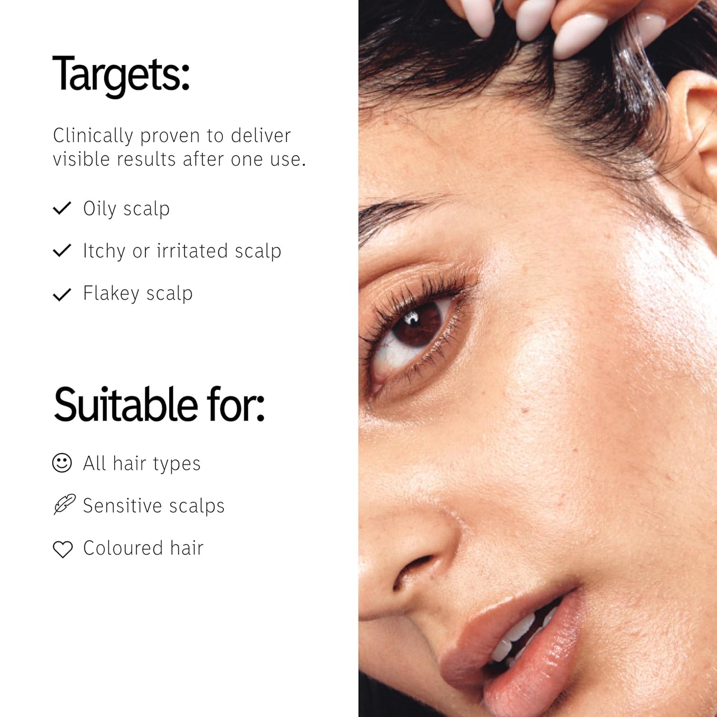 Salicylic Acid Exfoliating Scalp Treatment - Hydrating Oil & Moisturizing Scrub | 5 Fl Oz, All Hair Types