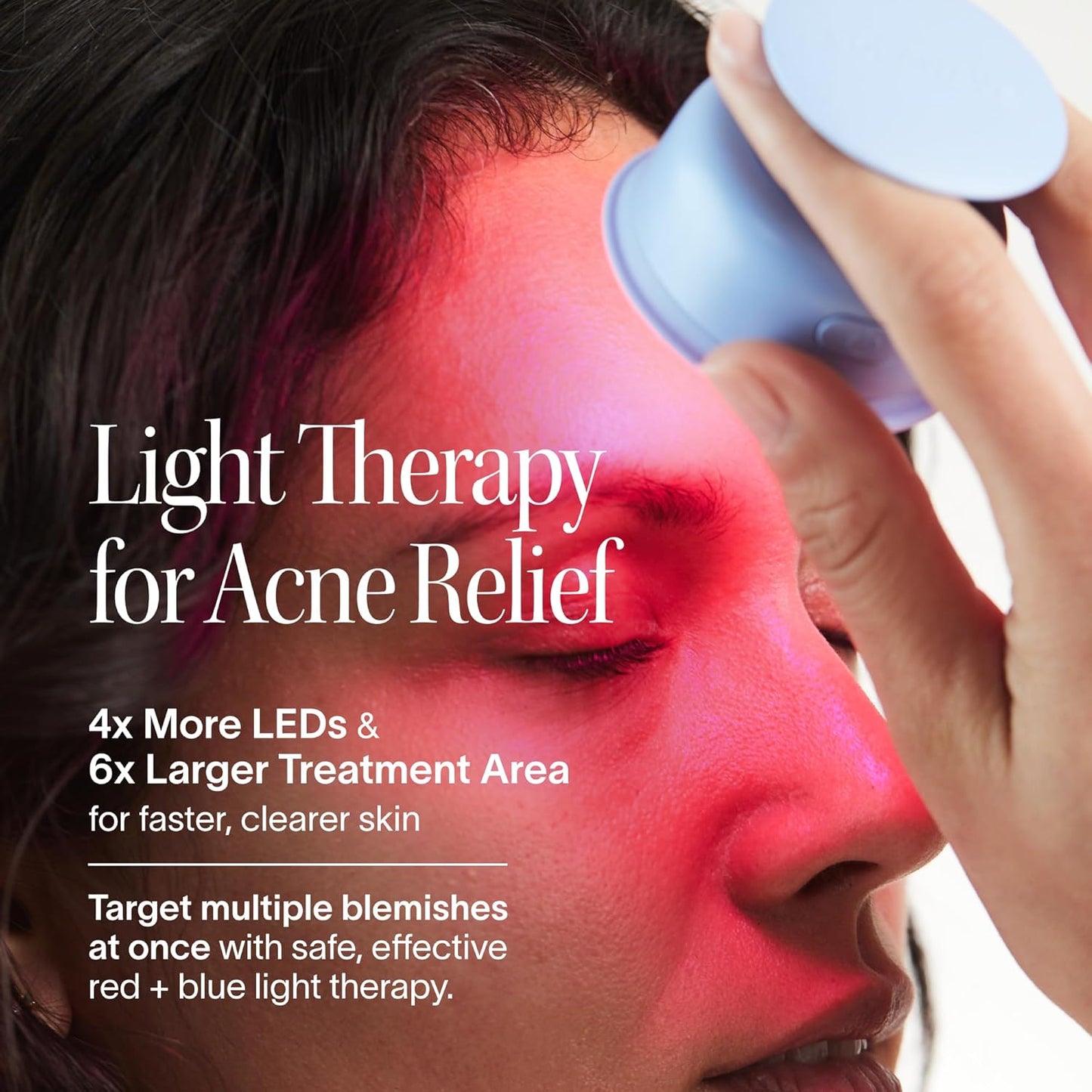 Bye Acne Blue & Red Light Therapy Device - LED Face Wand for Redness, Pimples & Blemishes | 3-Minute Treatment