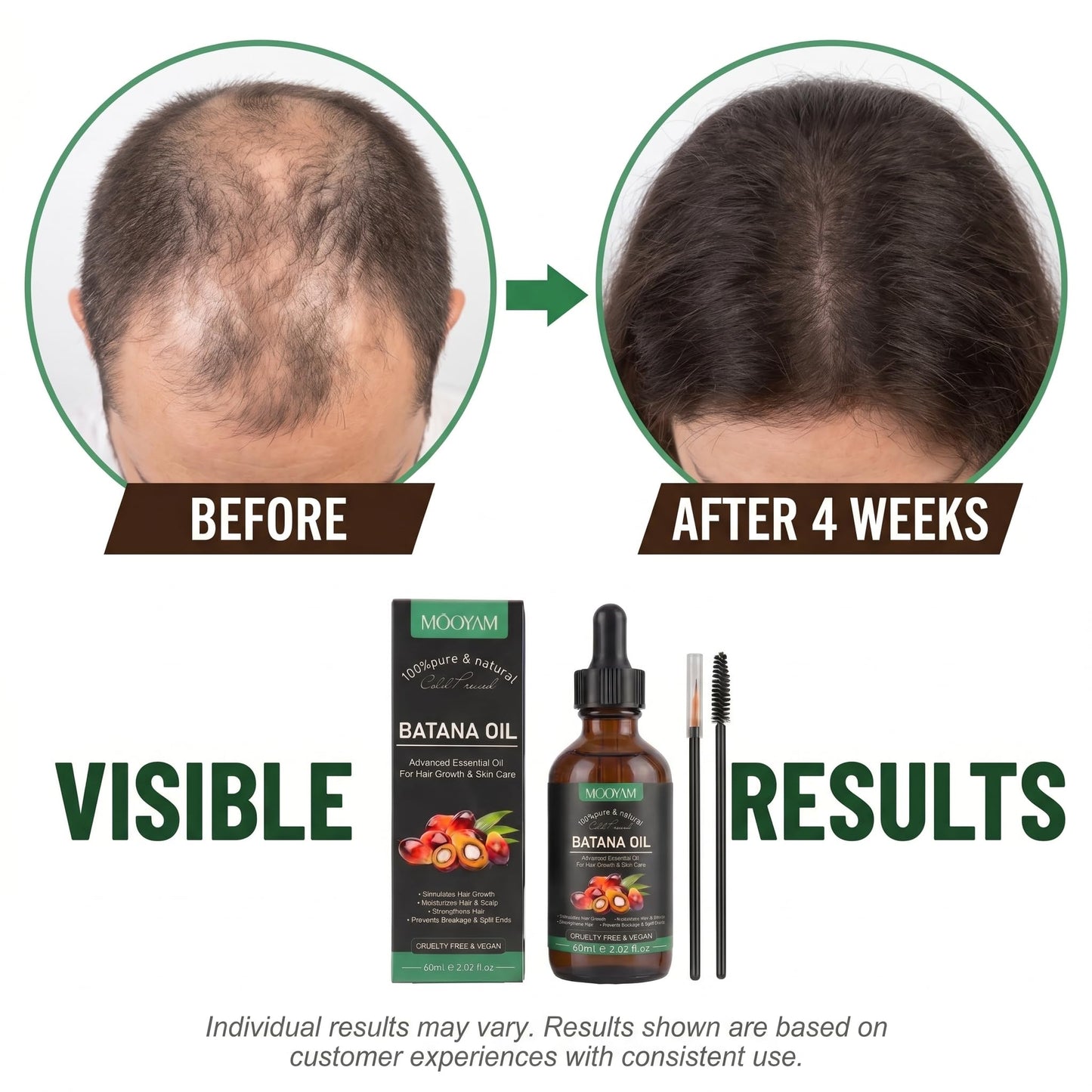 Batana Oil for Hair Growth – 100% Pure & Natural Cold Pressed Honduran Batana Oil, Stimulates Hair Growth, Strengthens Hair, Repairs Split Ends & Damaged Hair, All Hair Types, 2.02 fl oz (60ml)