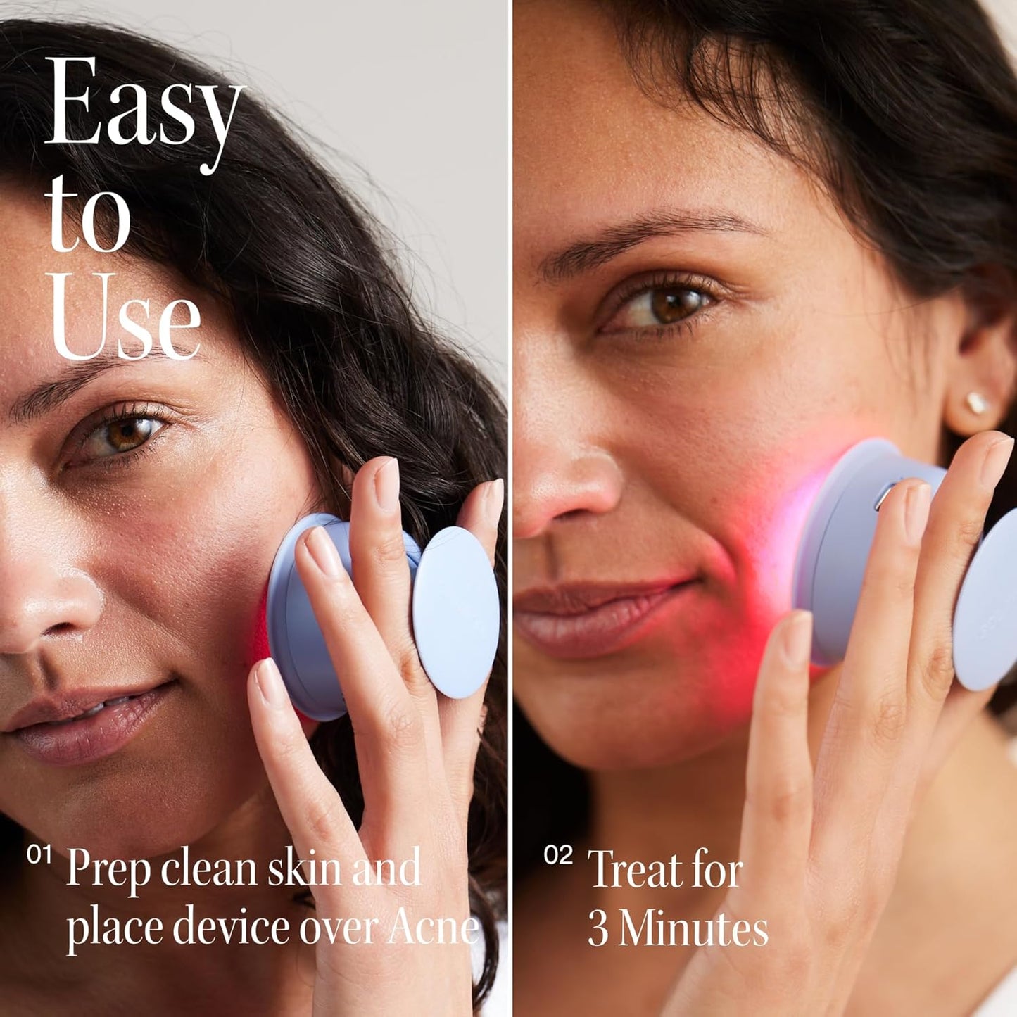 Bye Acne Blue & Red Light Therapy Device - LED Face Wand for Redness, Pimples & Blemishes | 3-Minute Treatment