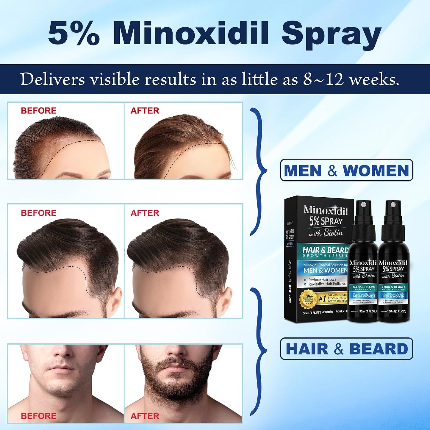 Minoxidil 5% Hair Growth Treatment for Men & Women - Regrowth Spray for Hair & Beard | 2-Pack