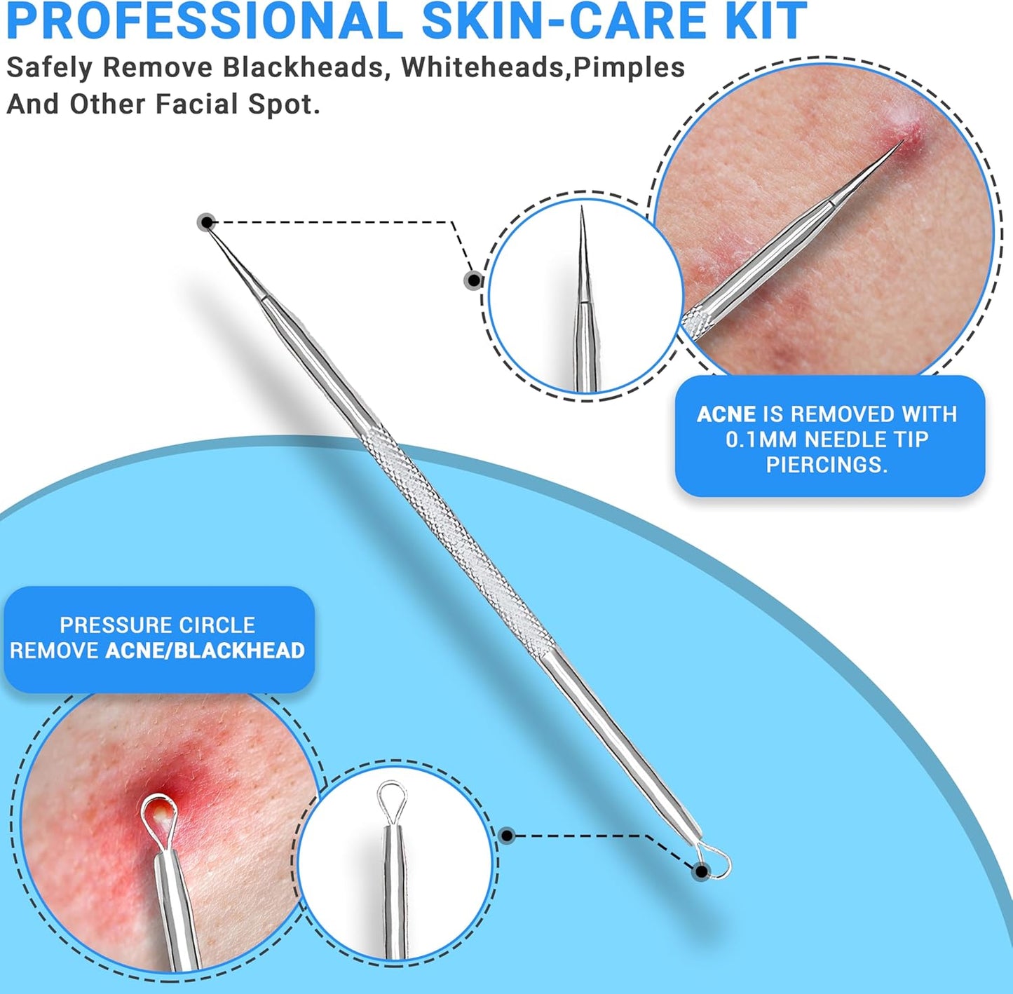 Stainless Steel Pimple Extractor Tool Set - Surgical Acne Treatment | Easy to Clean, 2 Pcs (Silver)