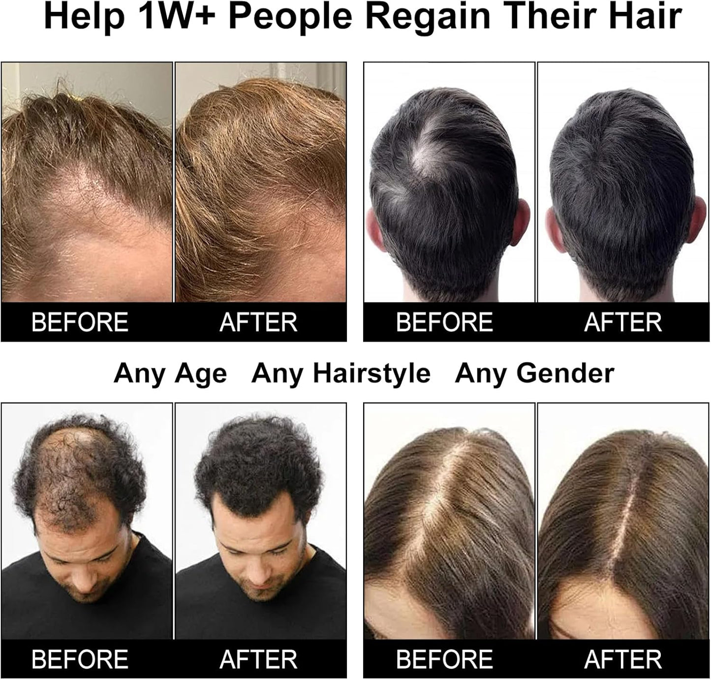 Laser Hair Growth Cap - Red Light Therapy for Hair Regrowth | Blue Light Hair Care to Reduce Hair Loss for Men & Women