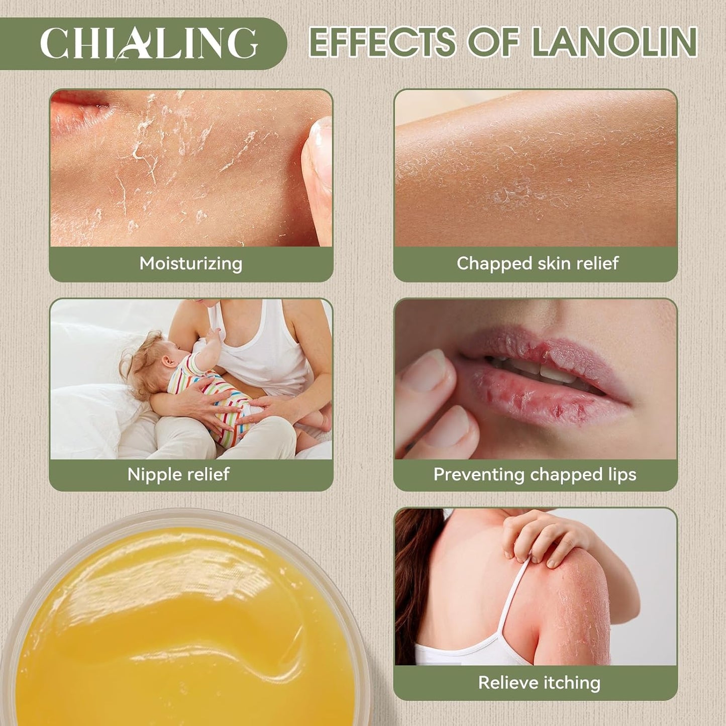 CHIALING 100% Pure Australian Lanolin Cream - USP Grade Moisturizer for Dry Skin, Eczema & Nipple Care | Unscented, 3.5 oz