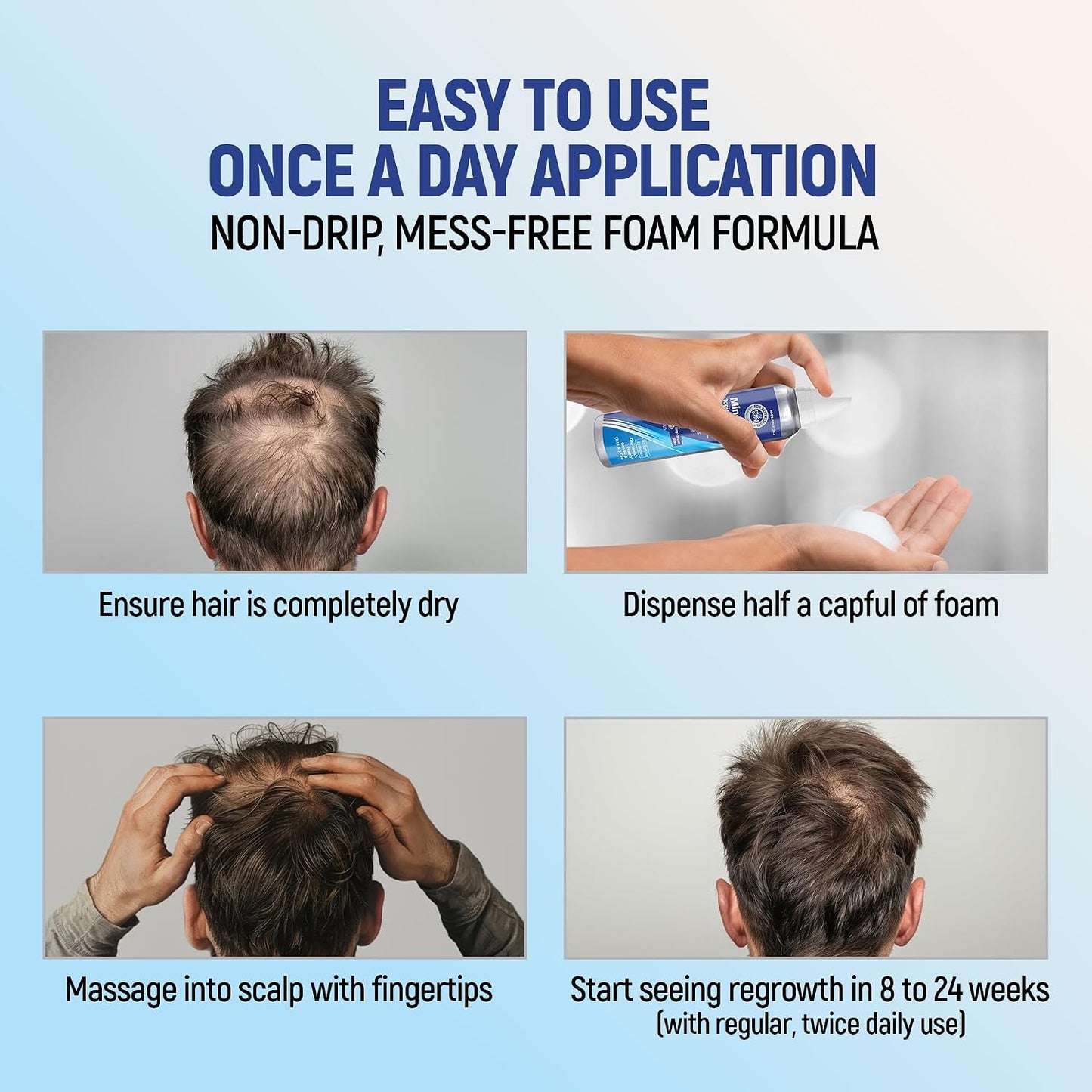 Minoxidil 5% Hair Regrowth Foam - 4-Month Treatment for Men | 2.11 oz (4 Pack)