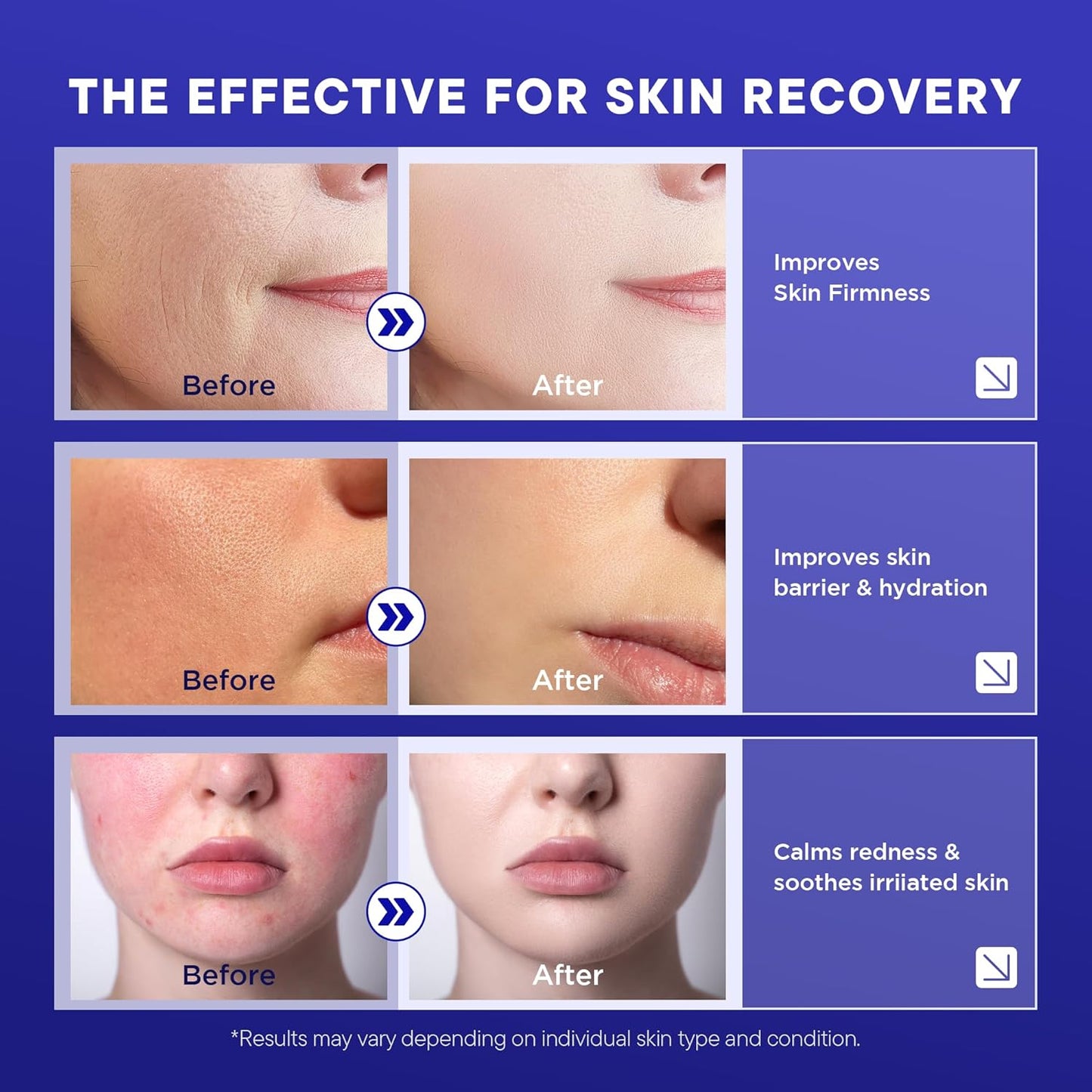 Copper Peptide Serum for Face | 1% GHK-Cu Anti-Aging Formula to Smooth Fine Lines & Boost Collagen - 30ml