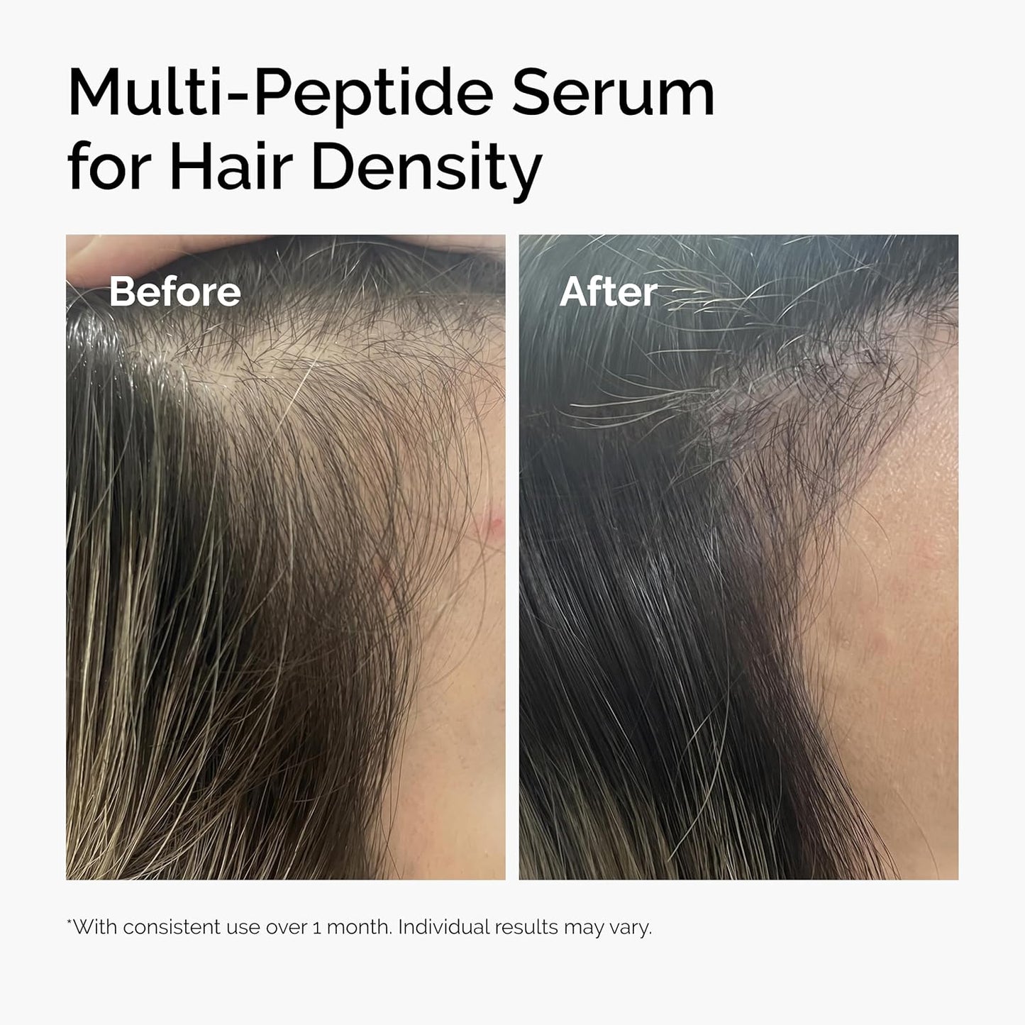 Multi-Peptide Hair Density Serum - Thicker, Fuller Hair Formula | Peptide-Powered Solution
