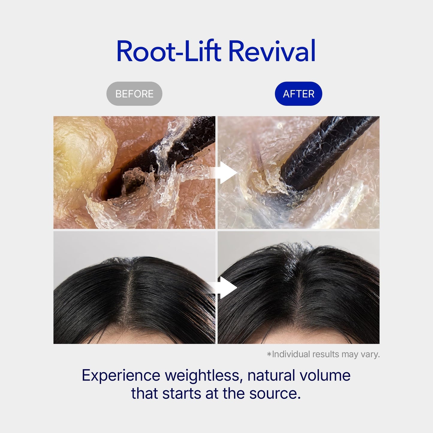 ViveLab Spioxyl 400 Microneedling Hair Growth Serum - Volumizing Scalp Treatment for Root Lifting, Scalp Care with Biotin, Caffeine & Peptides, Clinically Tested Spicule for Thicker & Stronger Hair