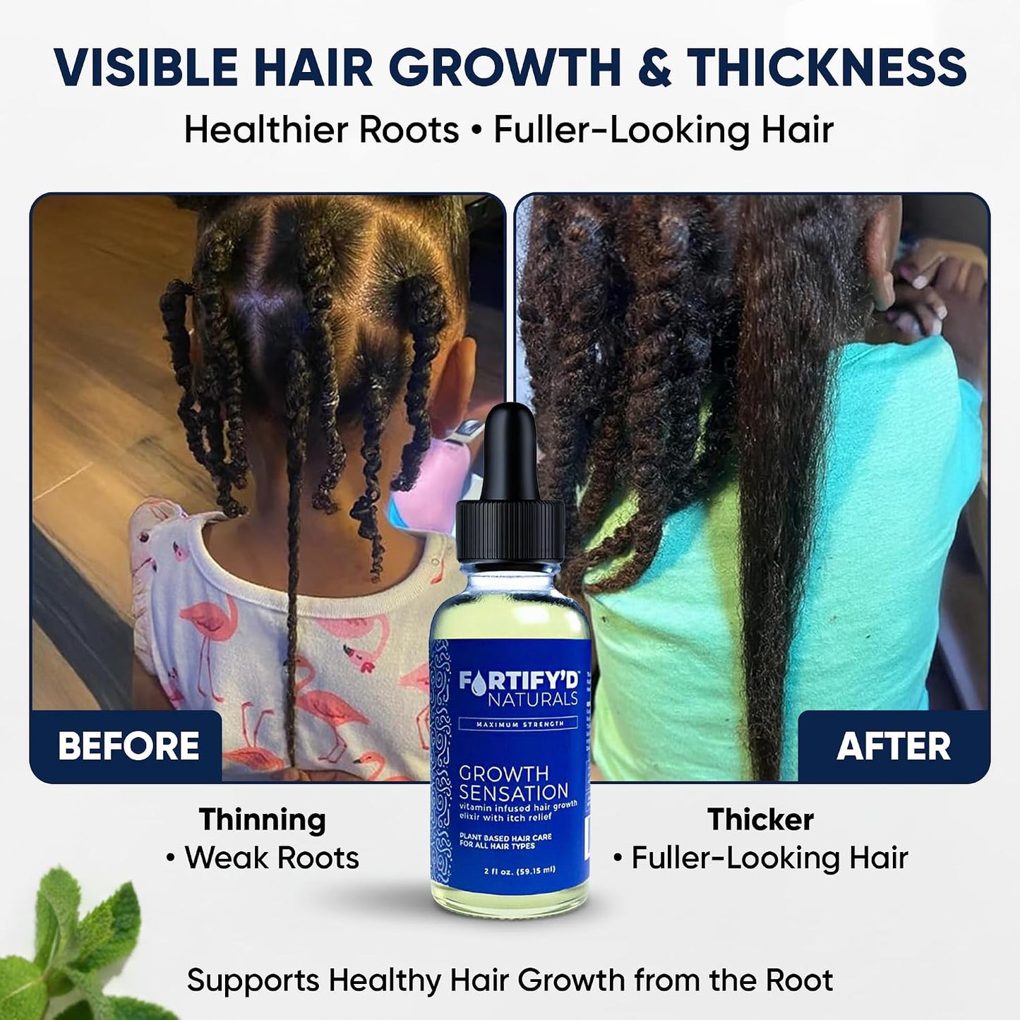 Hair Growth Elixir - Advanced Serum for Thicker, Fuller Hair | Dandruff Relief & Itch Relief | Oil-Free, Vegan