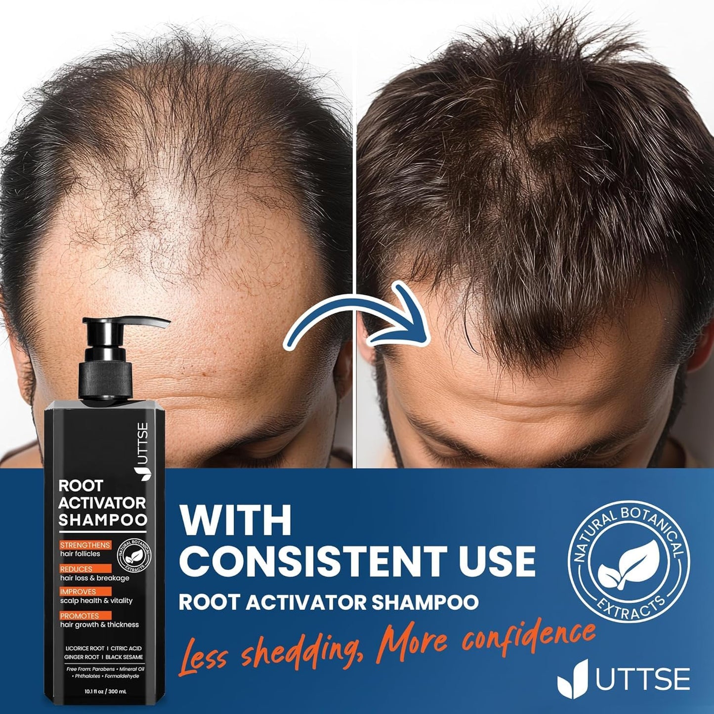 Root Activator Shampoo for Men - Hair Growth Solution for Thinning Hair & Hair Loss