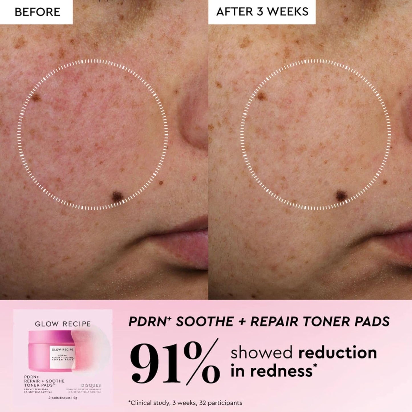 Glow Recipe Toner Pads Kit - 12-Piece Korean Exfoliating & Soothing Facial Treatment | Fragrance-Free for Sensitive Skin