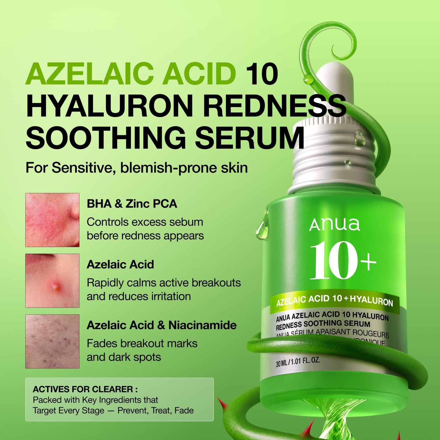 Anua Azelaic Acid 10 Hyaluron Redness Soothing Serum, Facial Serum for Blemish-Prone & Oily-Prone Skin, Lightweight & Hydrating Blemish Care, Hyaluronic Acid, Korean Skincare, 1.01 fl oz.
