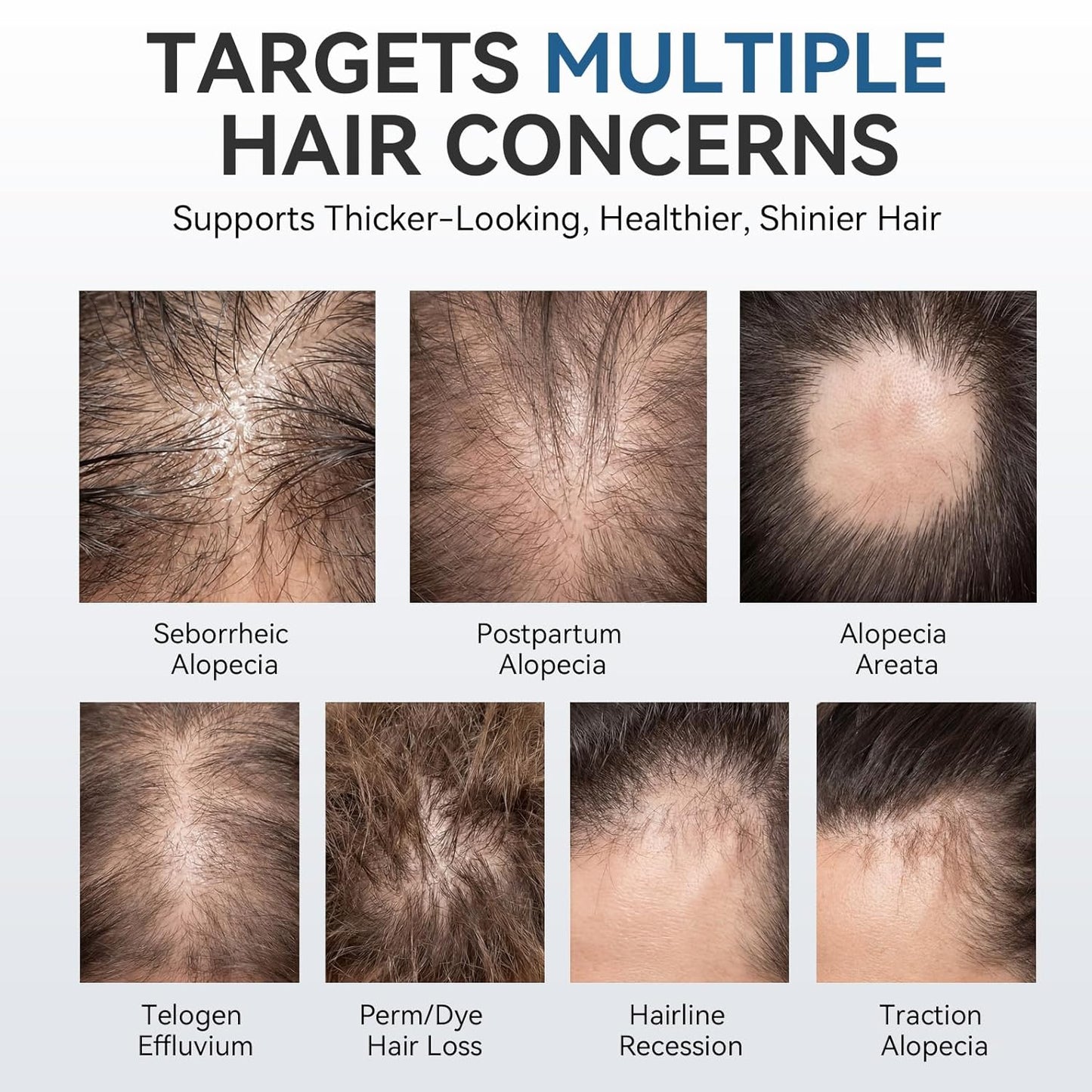 Hair Regrowth System - Multi-Peptide Serum with Copper Peptides & Ginseng for Thicker, Fuller Hair | Unisex