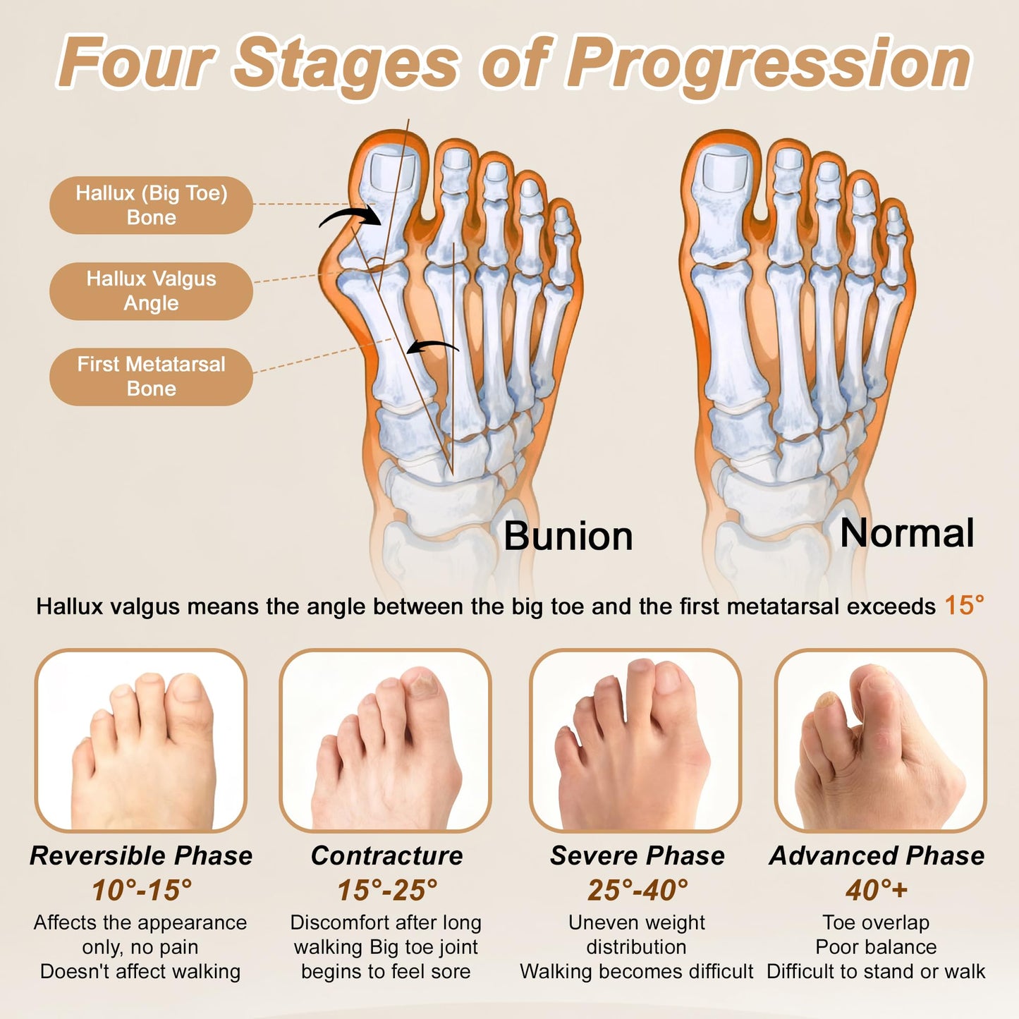 VOCOSTE 2Pair Silicone Toe Separators for Women & Men, Bunion Corrector Toe Sleeves, Breathable and Soft, Improve Foot Support for Daily Wear, Transparent