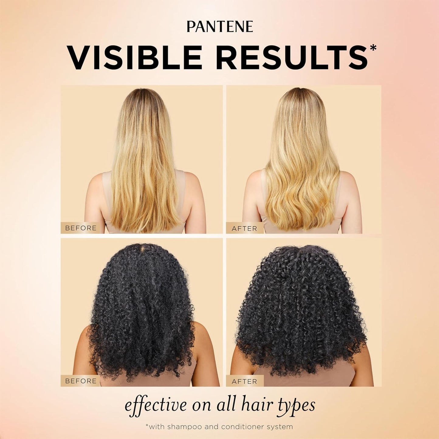 Pantene Abundant & Strong Hair Care Set | Shampoo, Conditioner & Serum for Thinning Hair - B5 Complex & Niacinamide, 3-Piece Regimen