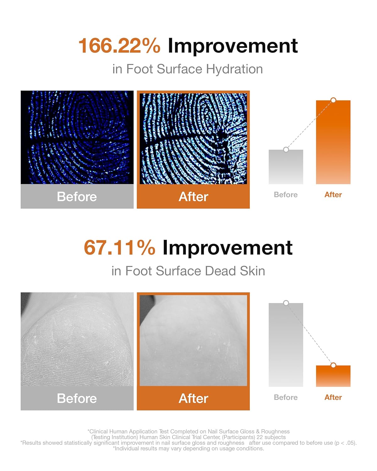 Foot Repair Cream - Intensive Moisturizer for Dry, Cracked Heels & Calluses | Shea Butter & Magnolia Extract Formula