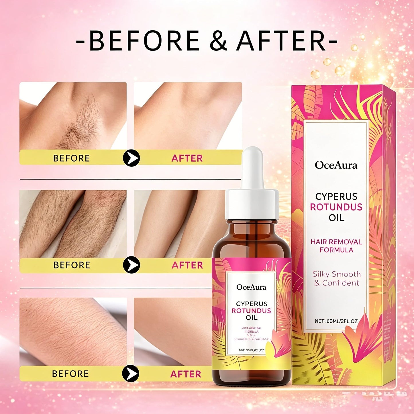 Cyperus Robundus Oil,Natural Cyperus Rotundus Oil for Hair Removal,Cyperus Rotundus Oil for Hair Removal Care,Moisturizing&Soothing Cyperus Oil Soothes Skin,Fit All Skin Types,Leaves Skin Smooth-60