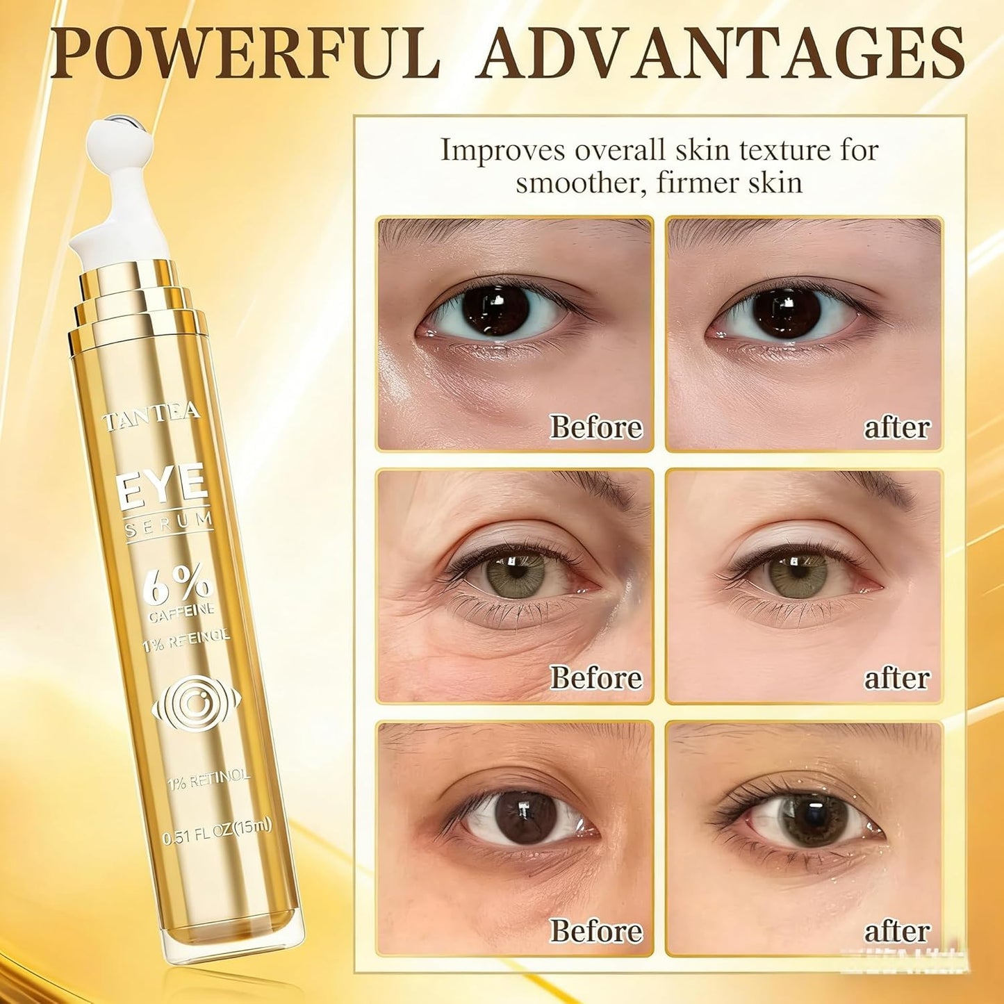 Caffeine Eye Cream for Dark Circles & Puffiness - Retinol Anti-Aging Serum for All Skin Types (0.52 Fl Oz)