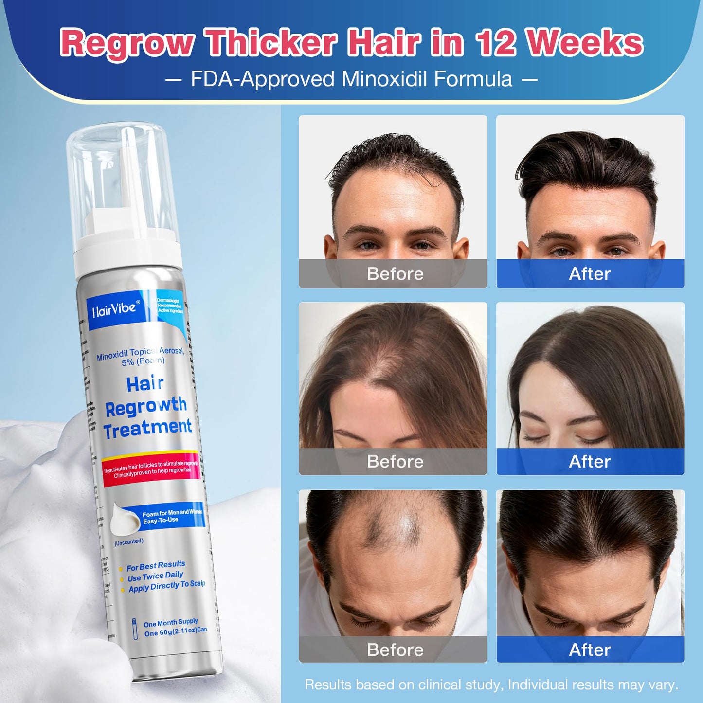HairVibe 5% Minoxidil Foam, Hair Regrowth Treatment for Men & Women, 2-Pack