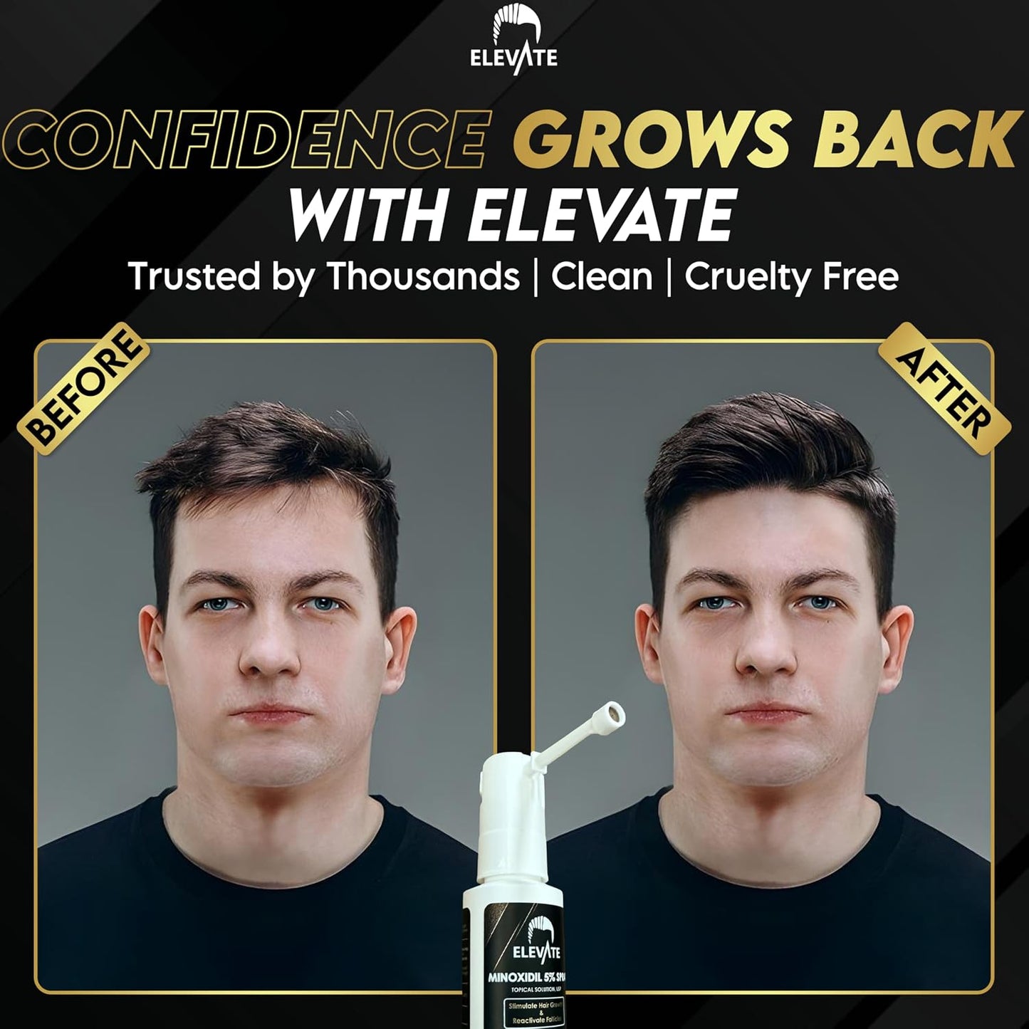 Hair Regrowth Treatment - 5% Minoxidil Spray for Men | Fast Absorbing, Unscented Formula for Thinning & Balding Hair
