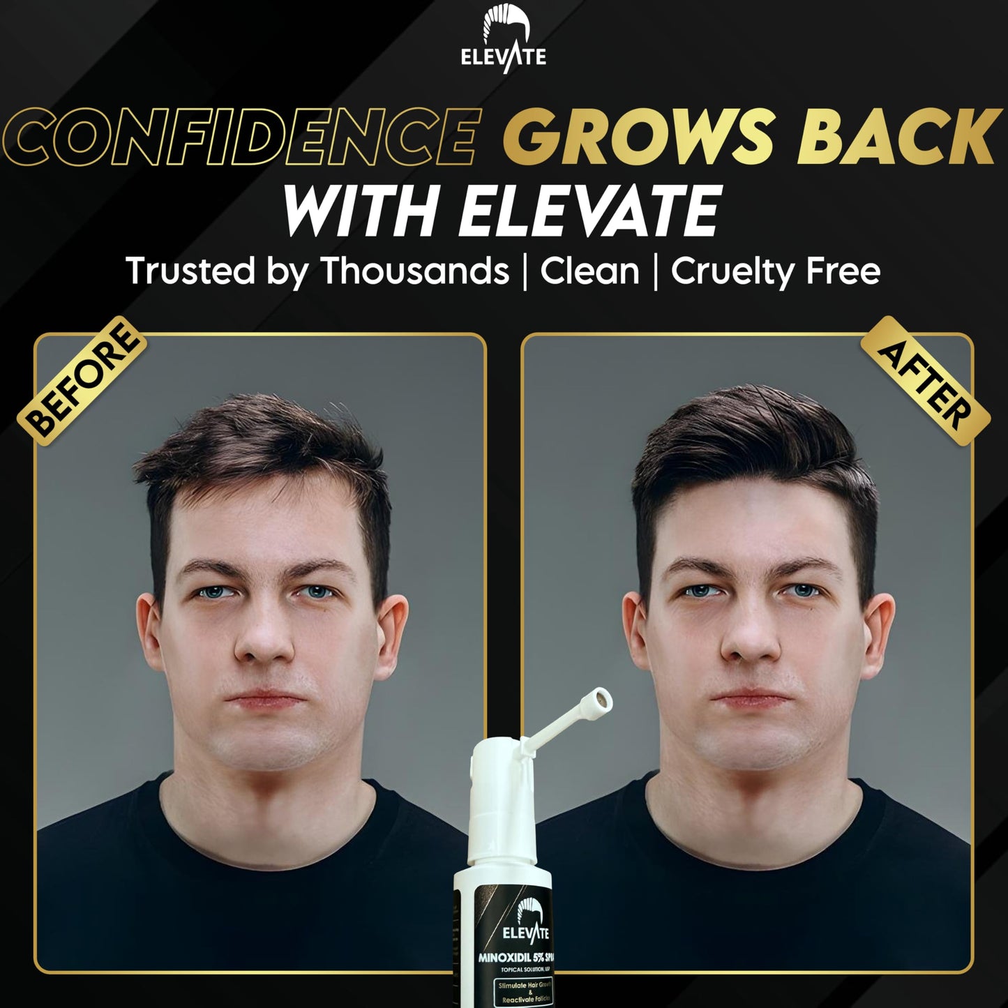 Elevate Hair Regrowth Treatment 5% Minoxidil Spray for Men - Clinically Proven Formula Fast Absorbing for Hair Loss and Growth Unscented Topical Hair Spray for Thinning & Balding Hair - Made in USA