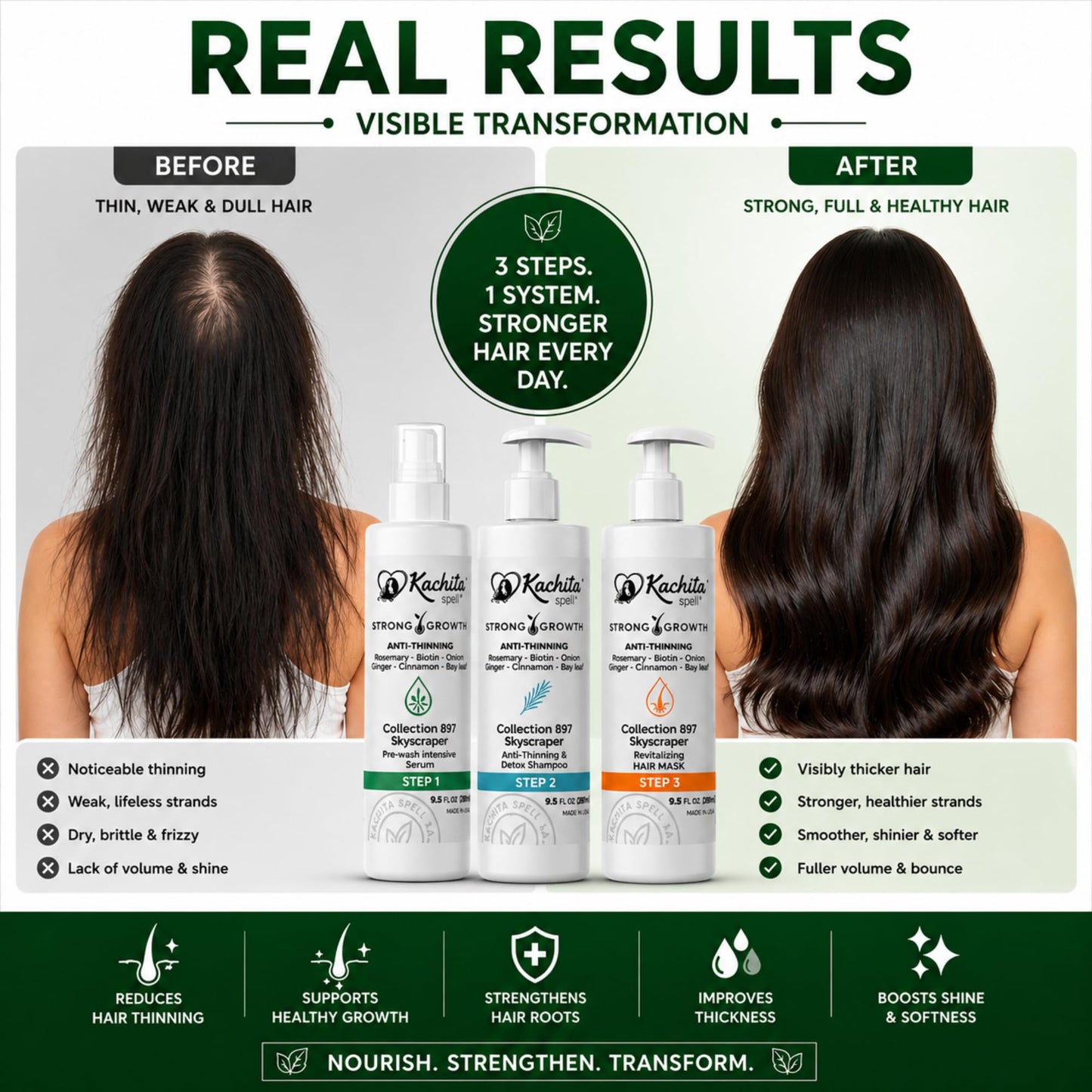 Kachita Spell Strong Growth Hair Care Set – Shampoo, Hair Mask & Serum with Biotin, Rosemary, Onion & Ginger – Anti-Thinning Hair Routine for Fuller, Stronger-Looking Hair, For Men & Women