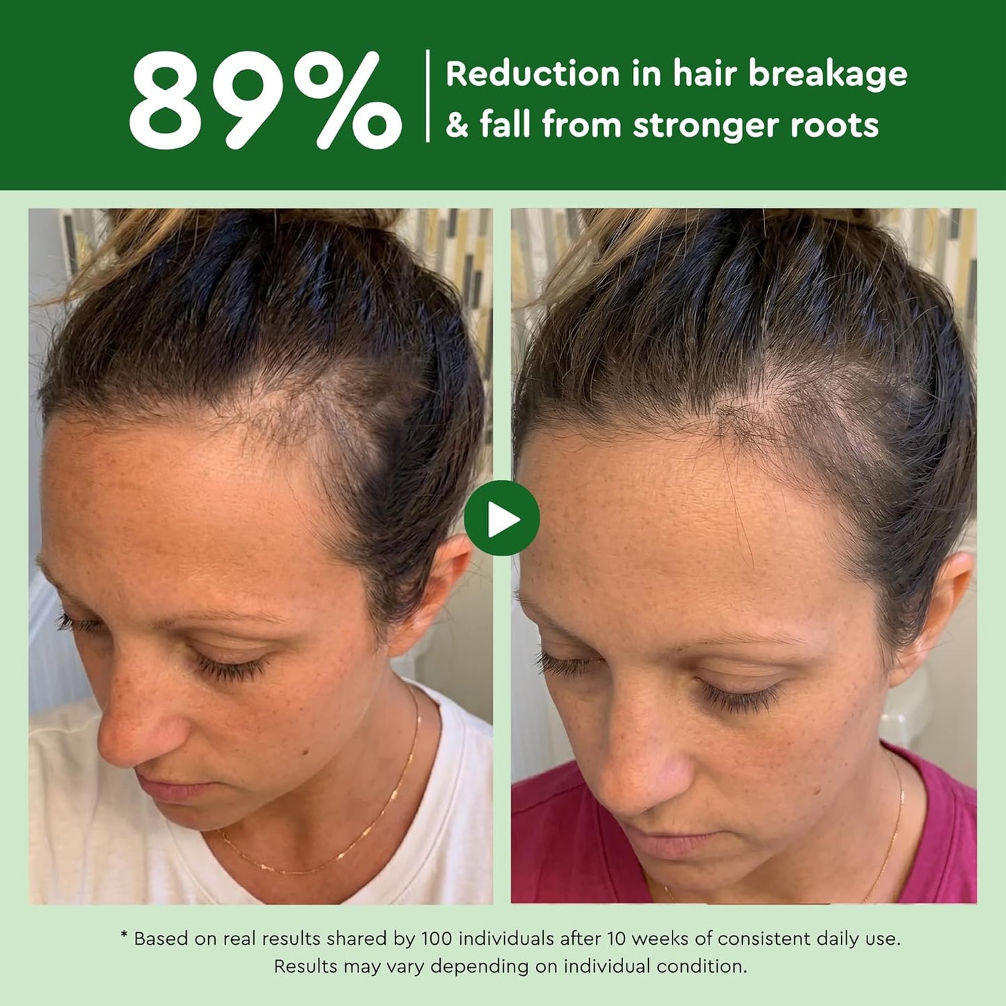 Rosemary Hair Growth Serum - Lightweight Ginger Formula for Thinning Hair | Non-Greasy Scalp Care (0.5 Fl Oz)