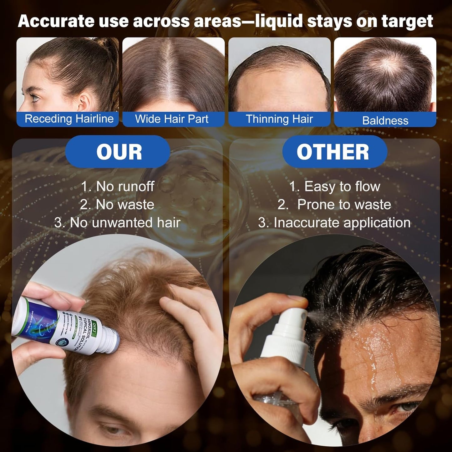 Minoxidil Hair Growth Serum - 5% Formula for Men & Women | Biotin-Infused, 4-Month Supply, 3 x 2.7 FL OZ