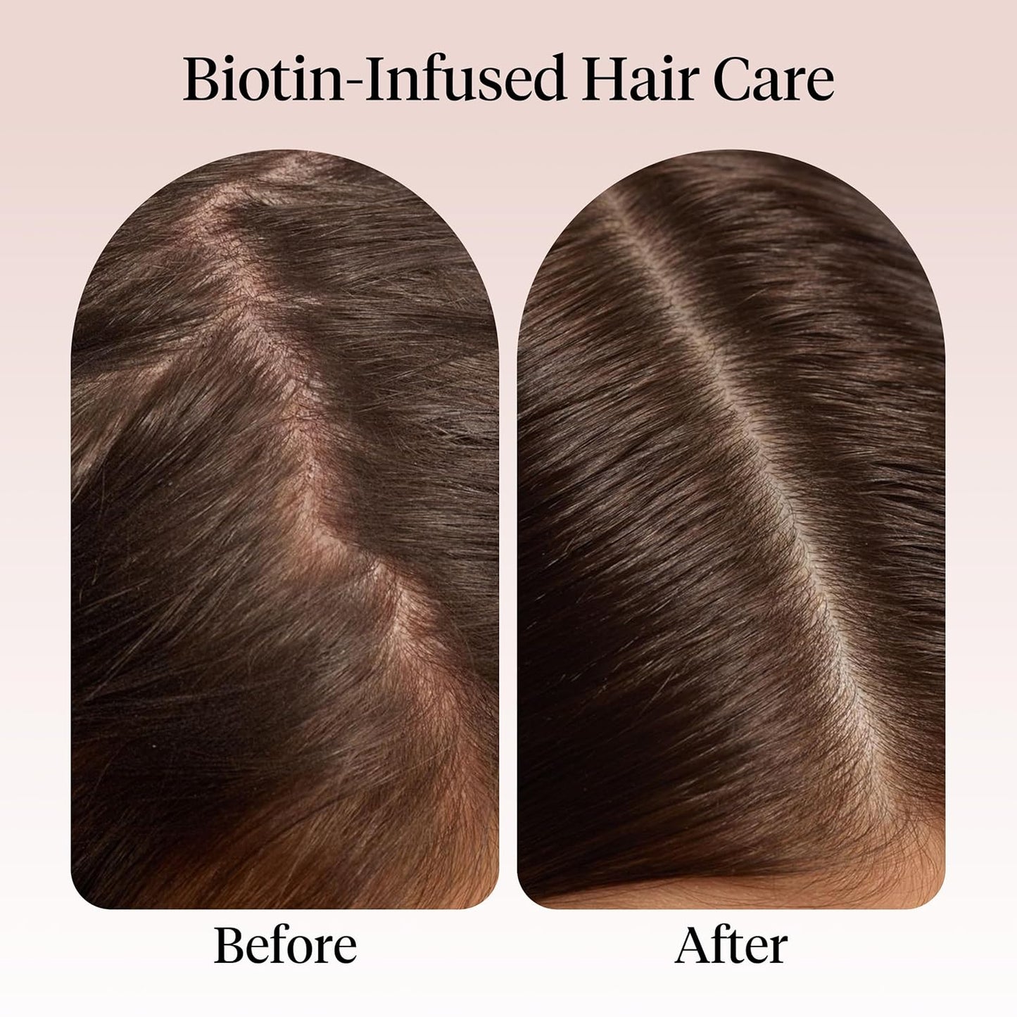 Rosemary Oil for Hair Growth - Pre-Wash Treatment with Castor & Biotin | Lavender Scent, 60mL - Strengthens Roots & Adds Shine