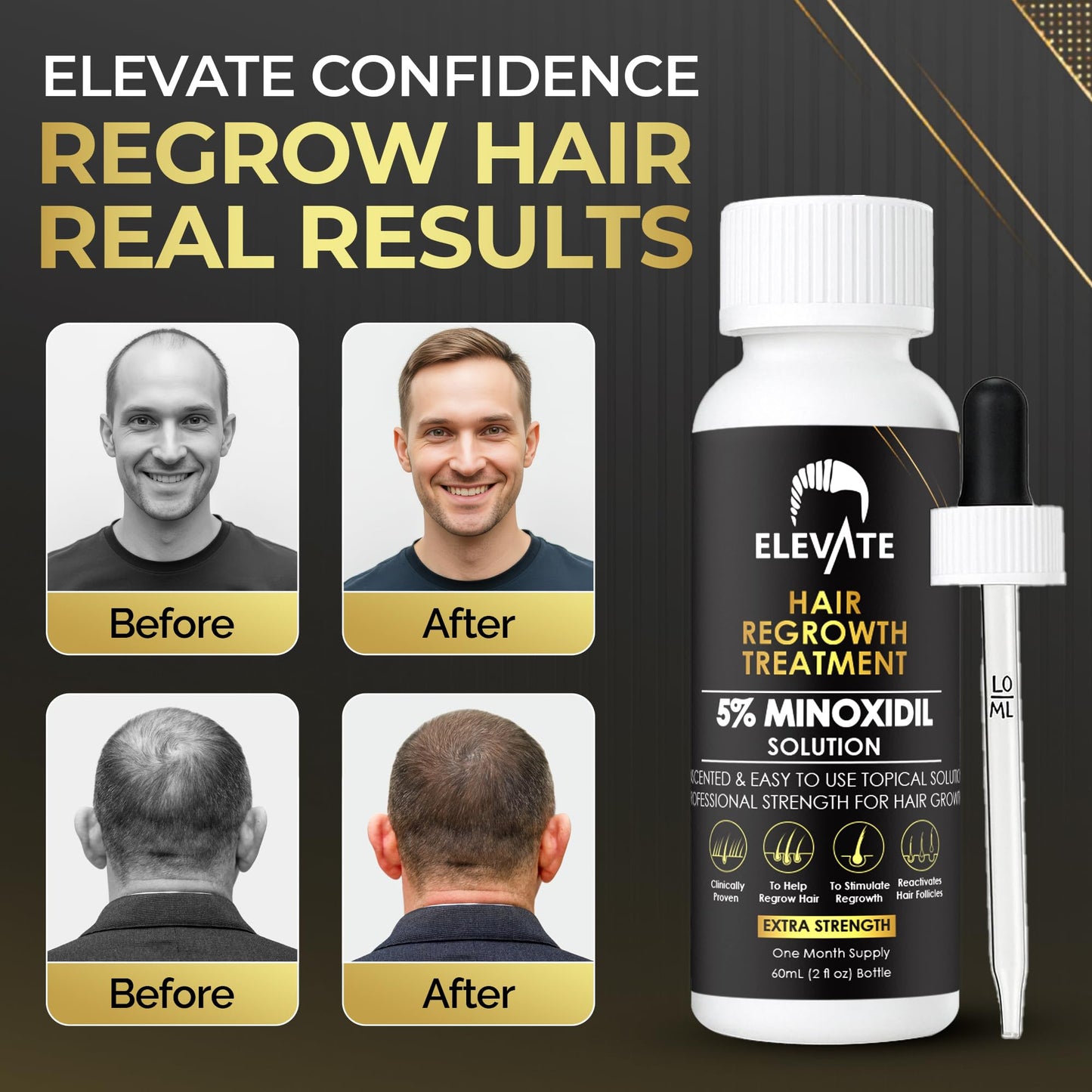 Elevate Hair Regrowth Treatment 5% Minoxidil Solution for Hair Growth - Extra Strength Topical Hair Growth Serum for Thicker, Fuller Hair 2 Fl Oz Made in USA