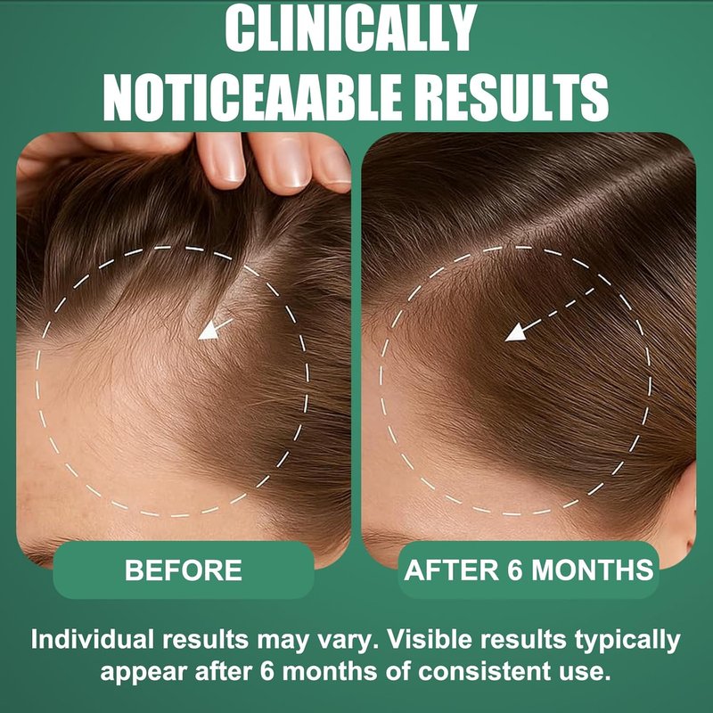 Minoxidil Hair Growth Treatment for Men & Women - Biotin & Rosemary Beard Growth Serum | Strengthens Roots, Repairs Thinning Hair