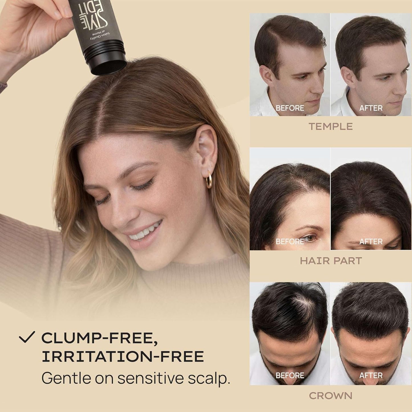 Hair Building Fibers for Thinning Hair - Plant-Based Concealer for Receding Hairlines & Bald Spots | Black 0.88oz