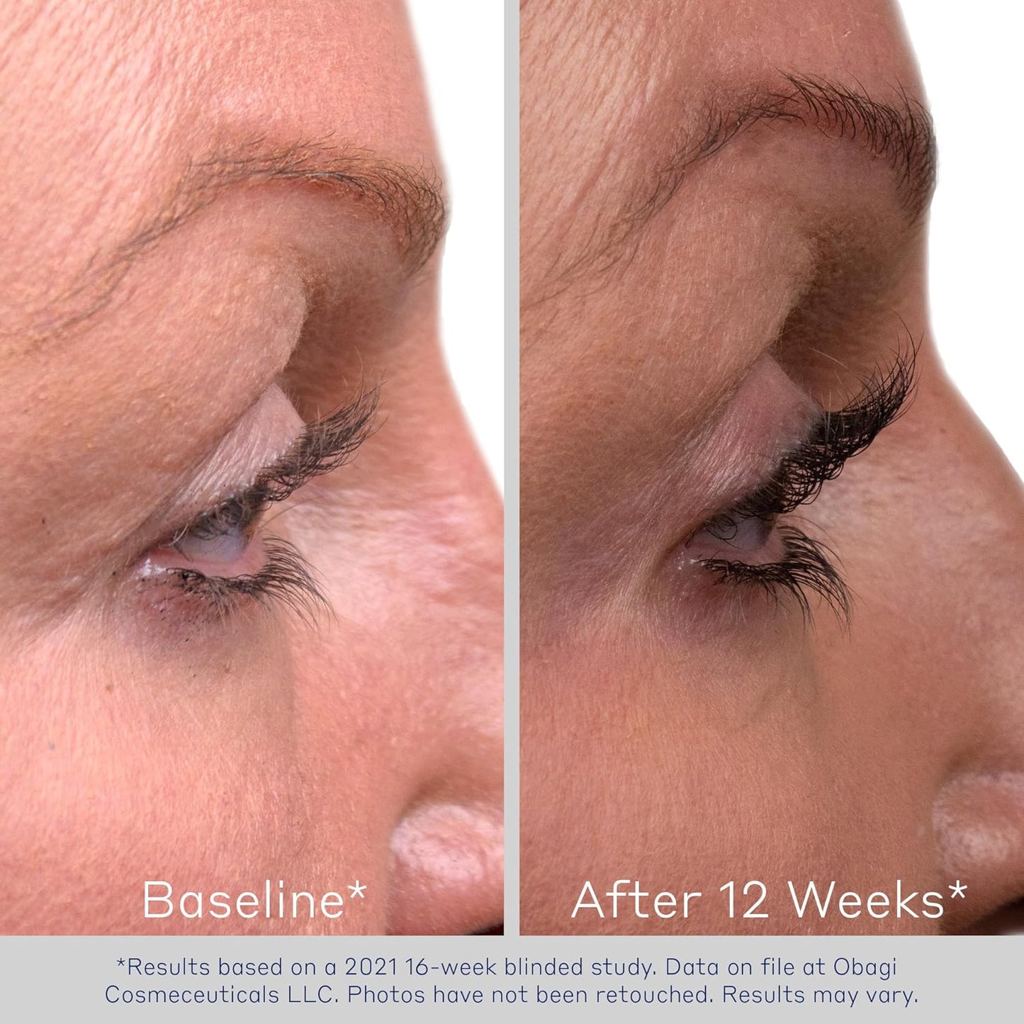 Obagi Eyelash Enhancing Serum - Nourishing Biotin Formula for Thicker, Defined Lashes | 0.5 oz