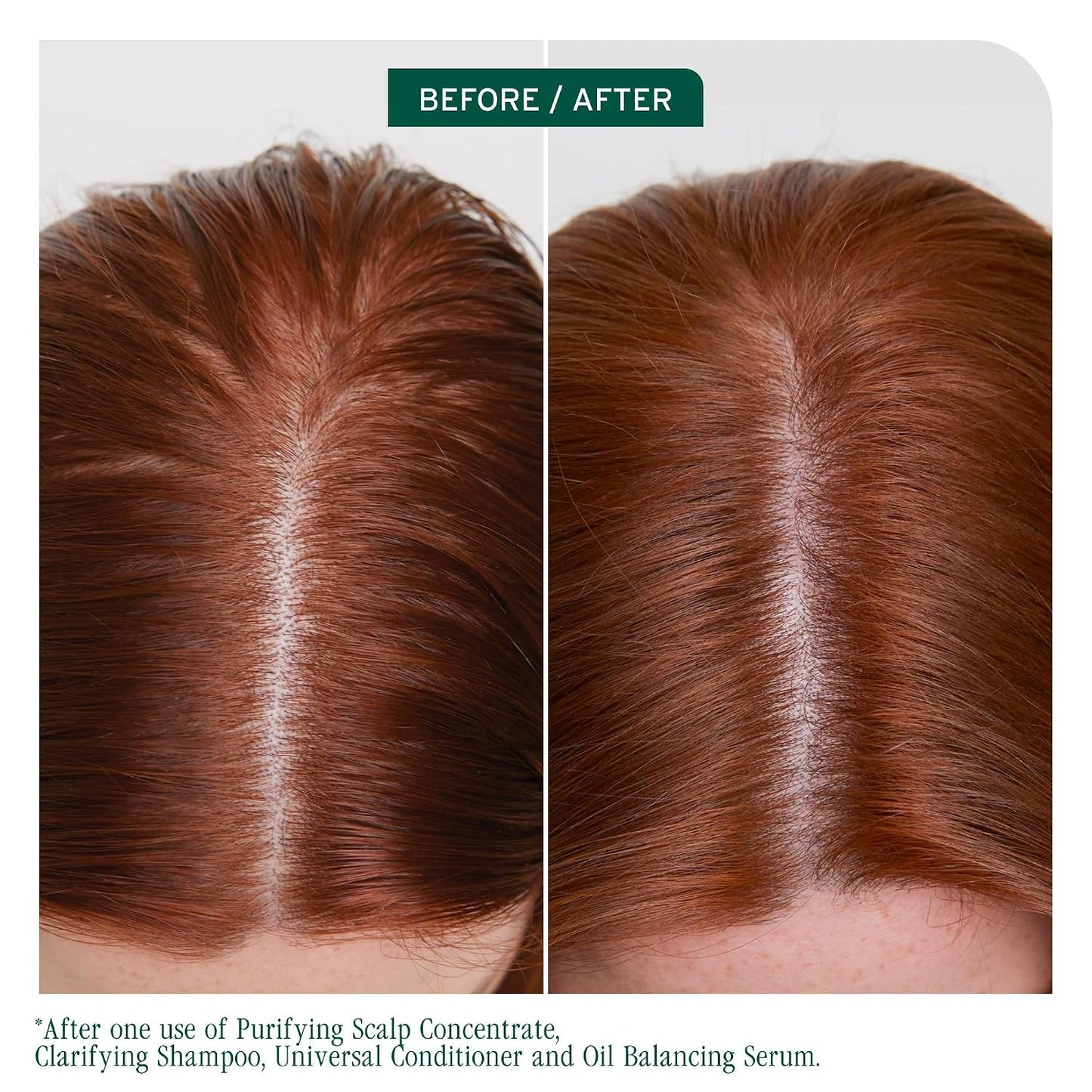 Biolage Scalp Sync Clarifying Shampoo - Deep Cleanse Oily Scalp | Residue & Buildup Remover