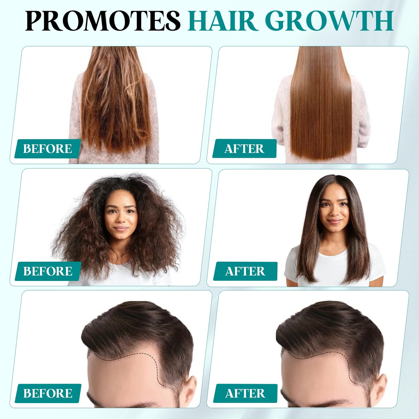 Batana Oil Hair Growth Formula – 100% Unrefined Natural Treatment with Potent Blended Oils – Promotes Thicker Hair, Reduces Thinning & Repairs Scalp Damage – 4oz”
