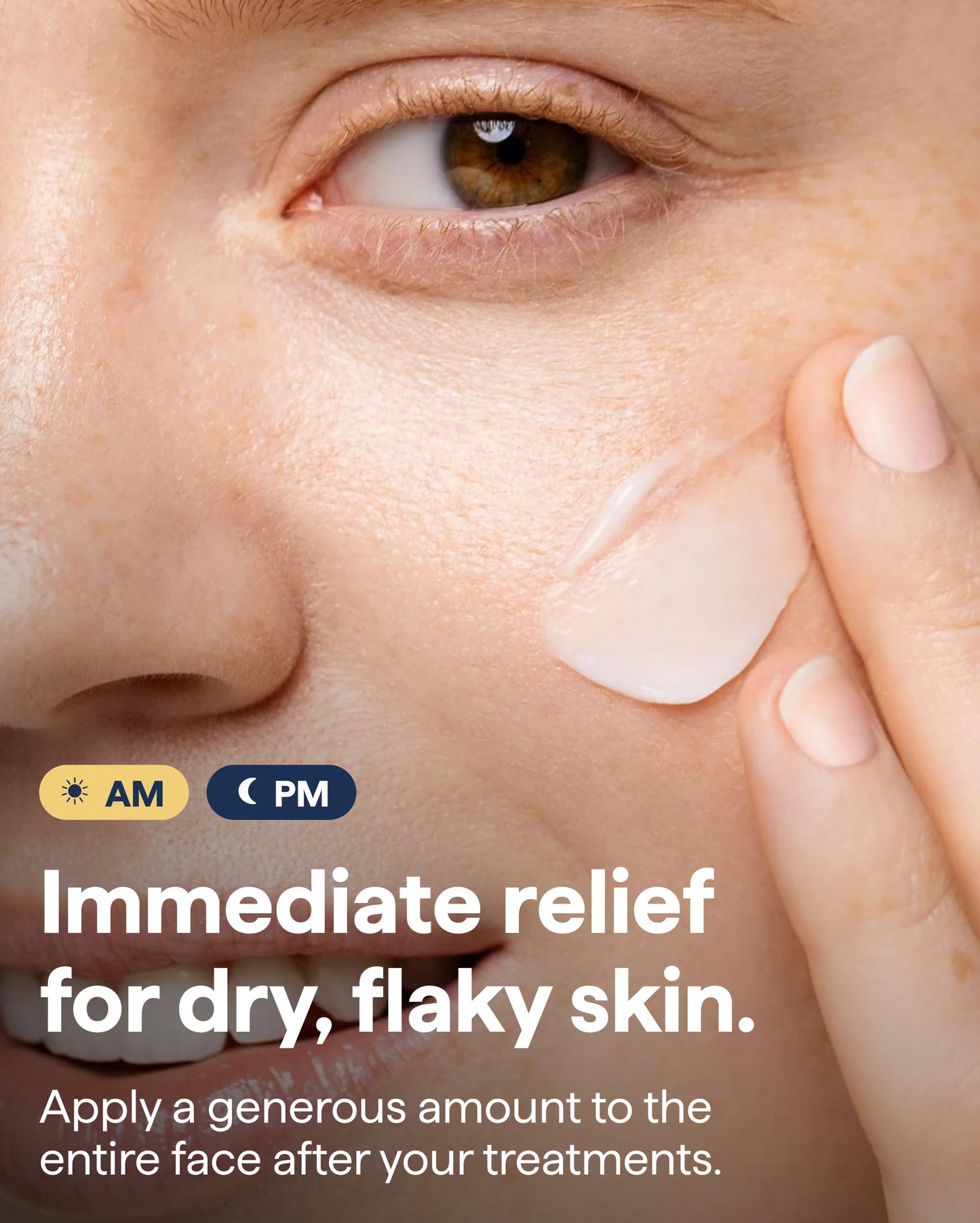 Remedy Rich Barrier Repairing Cream Face Moisturizer | Quadruple Ceramide Complex, Peptides and Squalane | Fragrance Free | Eczema Certified | Dry Sensitive Skin | By Dermatologist Dr Shah | 1.7 fl oz