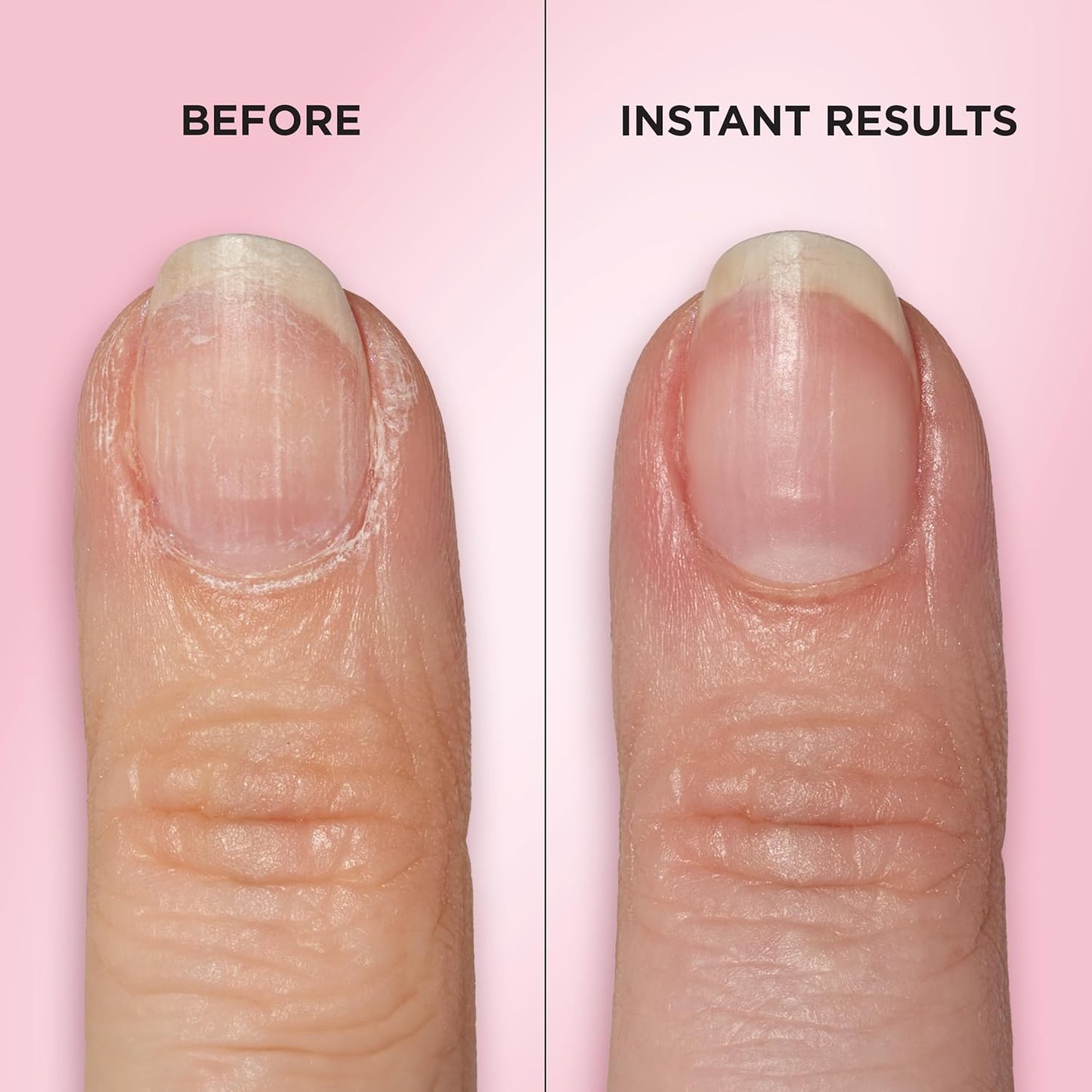 Sally Hansen Cuticle Care Treatment Pen - 2-in-1 Exfoliator & Polisher | Textured Tip for Smooth Cuticles