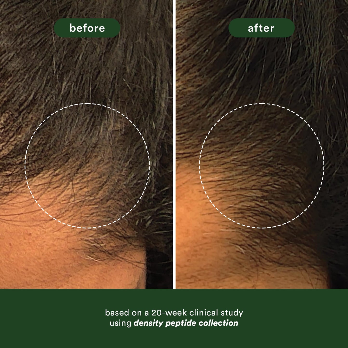 VERB Density Peptide Serum, 1 fl oz - Visibly Thicken + Reduce Signs of Shedding- No Parabens or Harmful Sulfates