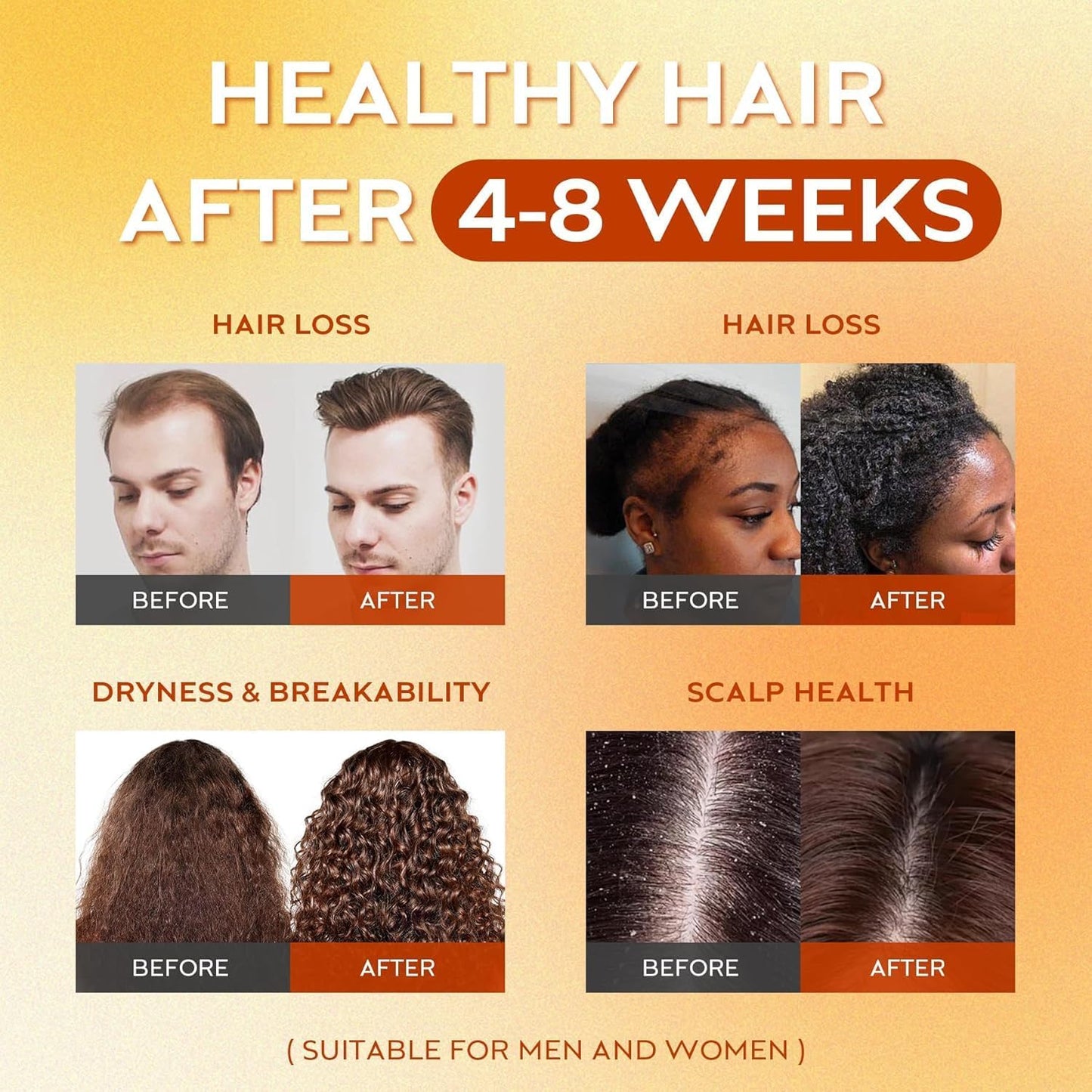 Raw Batana Oil for Hair Growth, Raw Batana Oil for Hair Growth, Strengthens, Moisturizes, Reduces Hair Fall, Scalp Oil Promotes Hair Thickness, Prevents Hair Loss for Men & Women